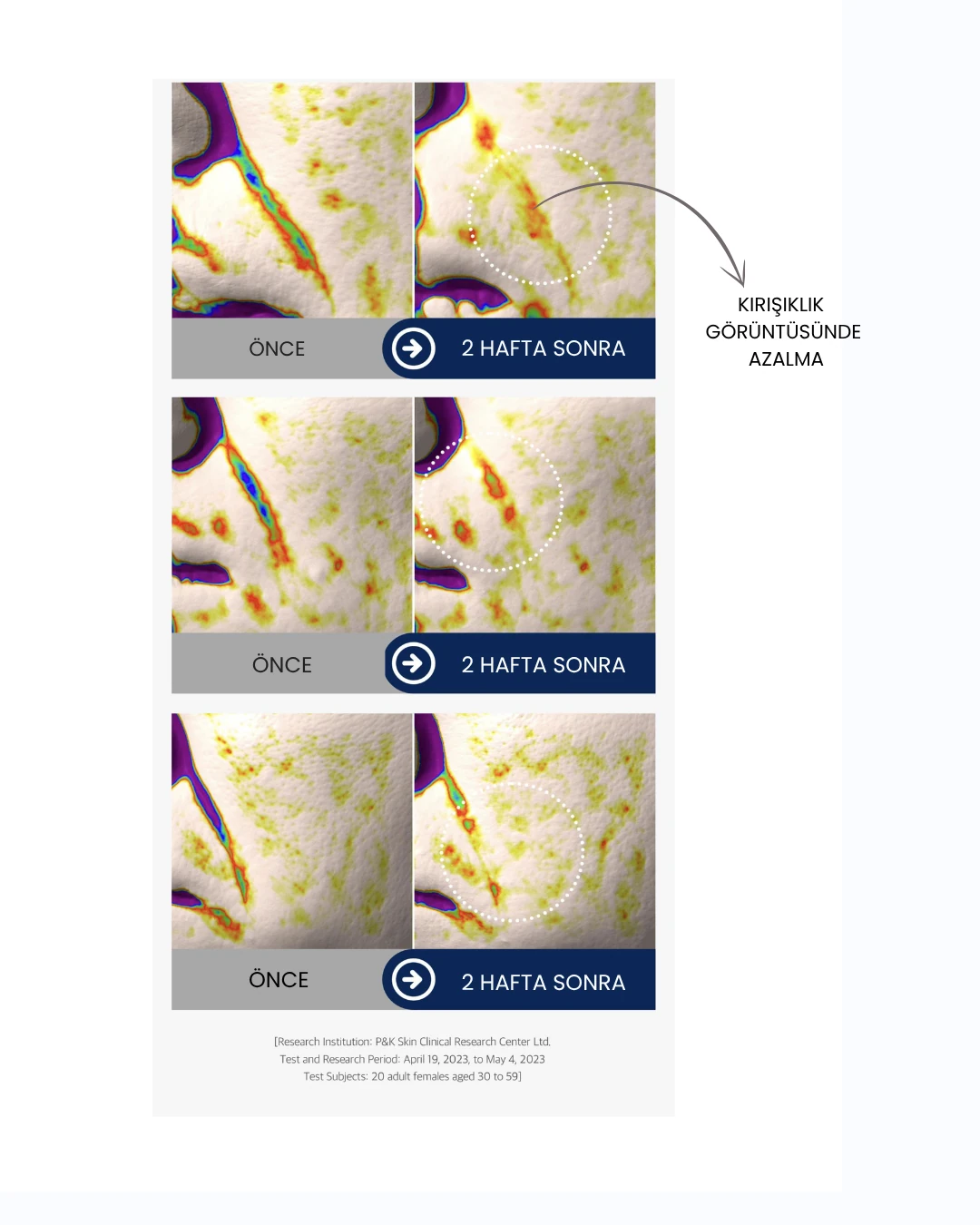 Snowtox Botox Etkili Serum: Kırışıklık Karşıtı & Yoğun Nemlendirici Formül | Miaderm