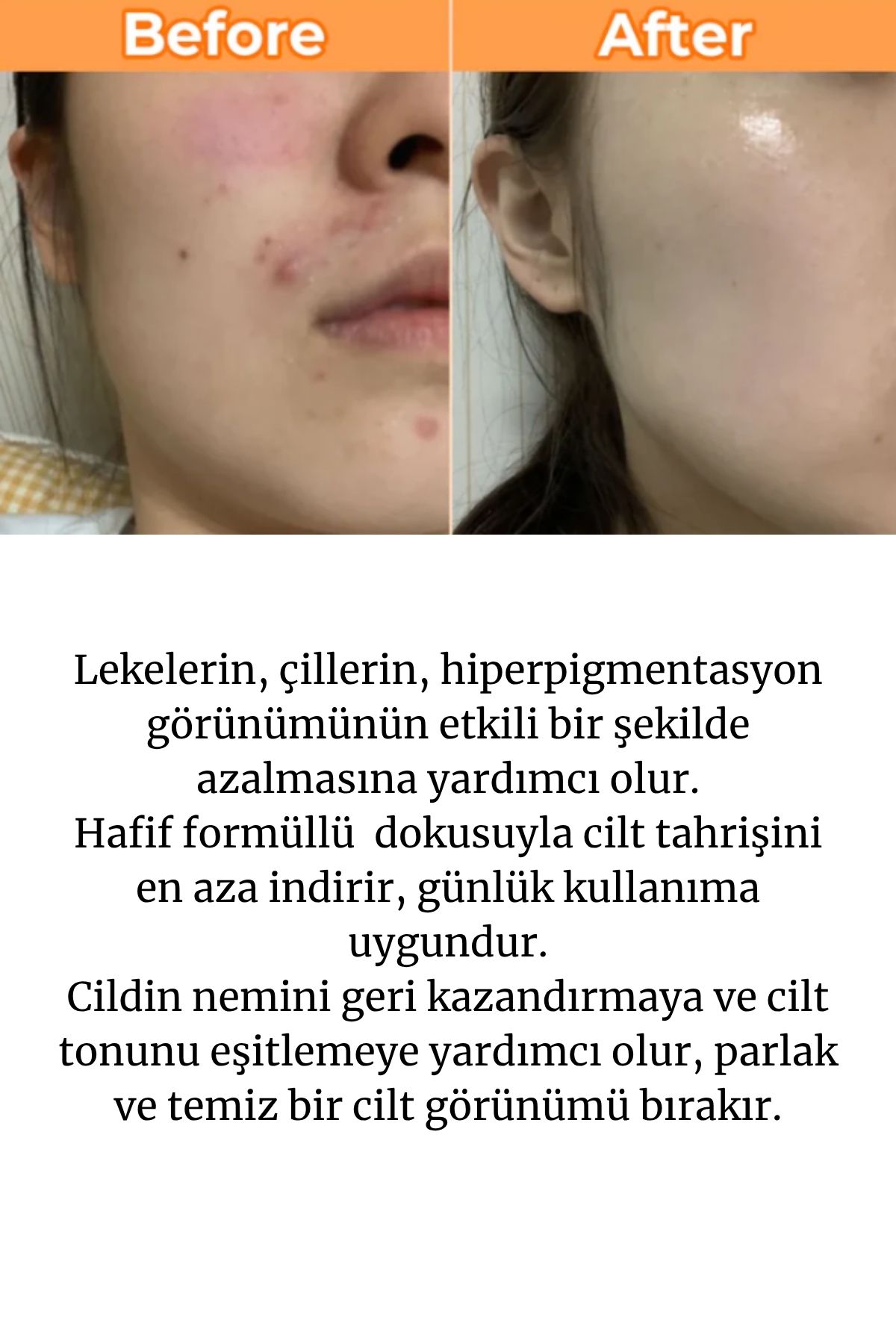 Prebiyotik İçerikli Leke Karşıtı Aydınlatıcı Ve Ton Eşitleyici Serum 30ml