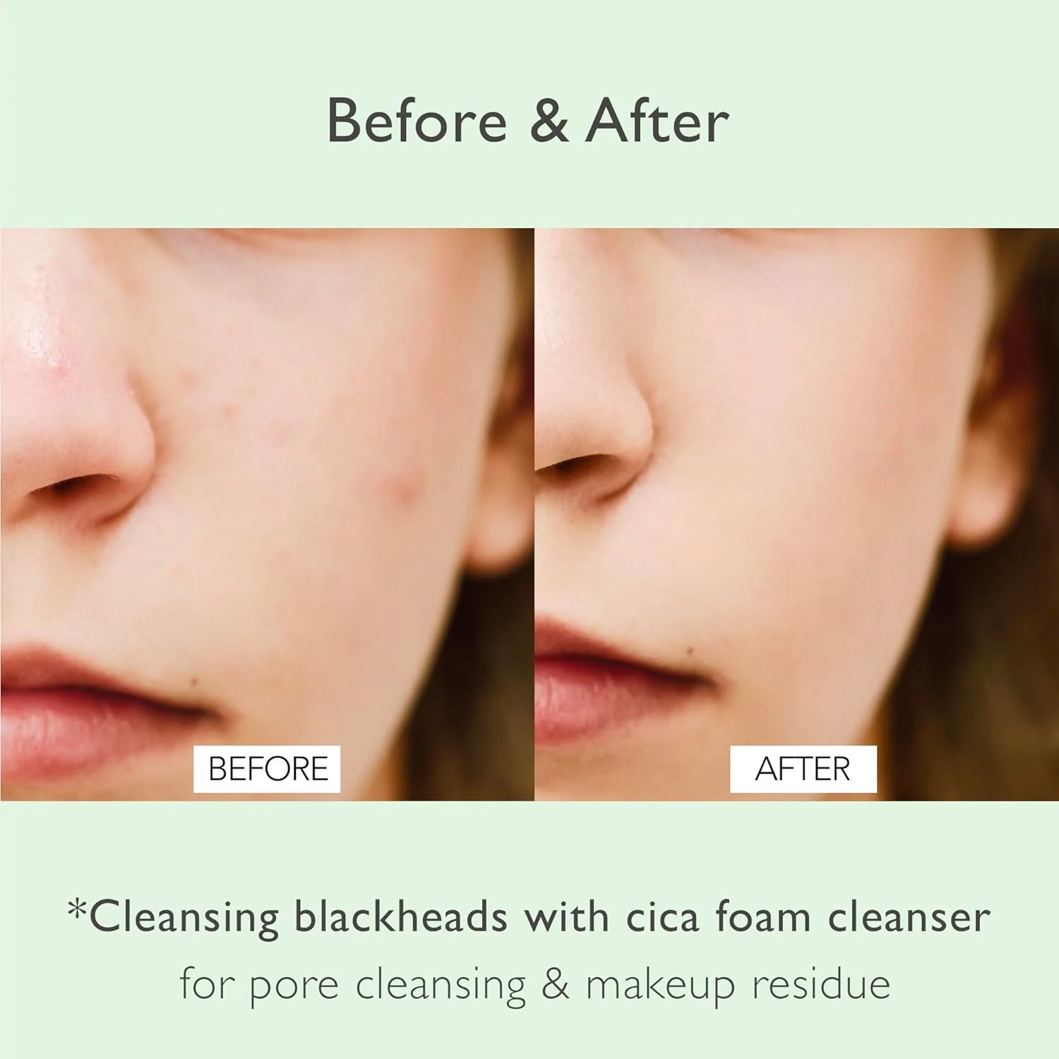 Nowater Cica Pore Arındırıcı Köpük Temizleyici – Cilt Bariyer Dostu