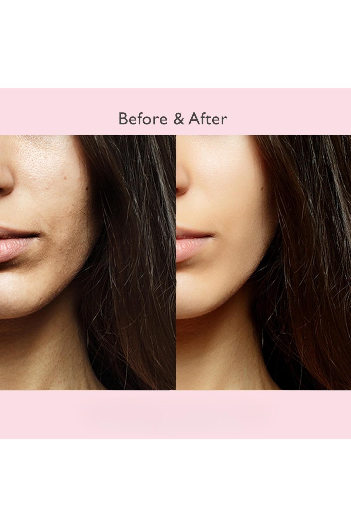 Prestige 73 Soyulabilen Kolajen Maske