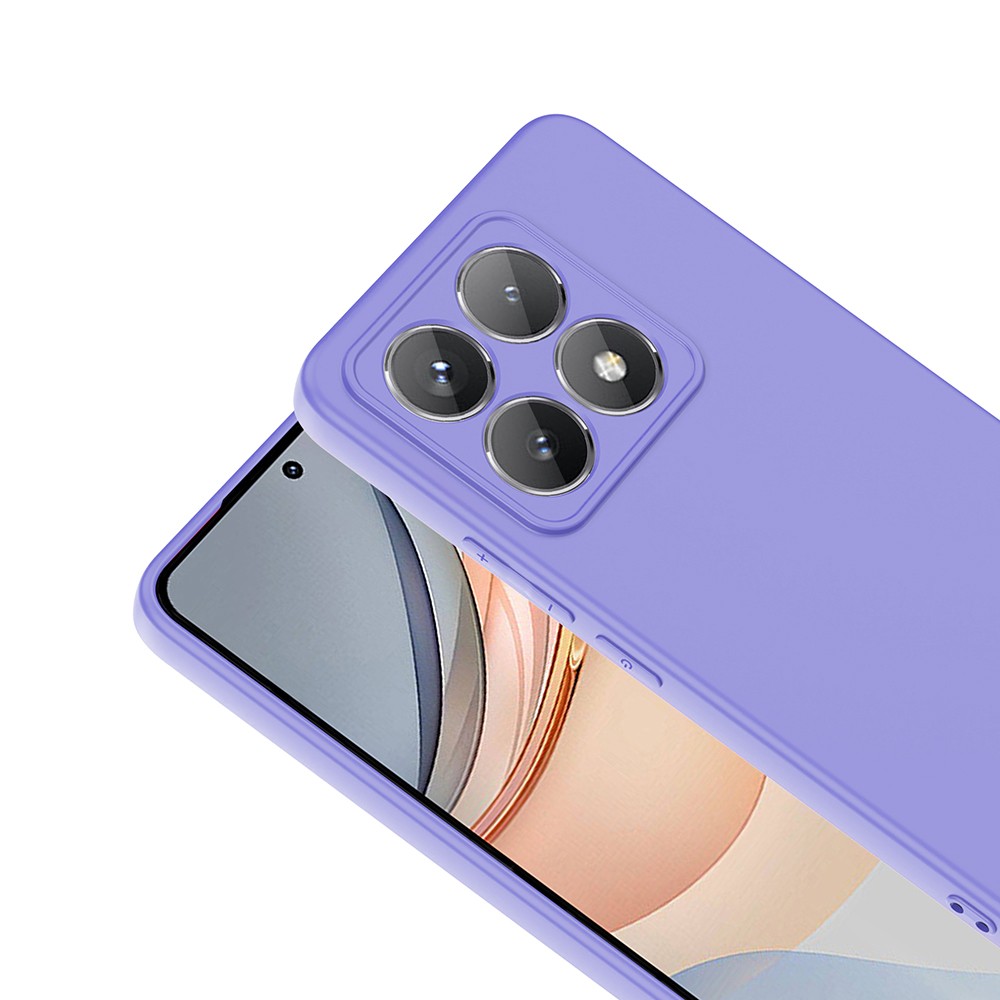 Xiaomi 14T Kılıf Zore Mara Lansman Kılıf