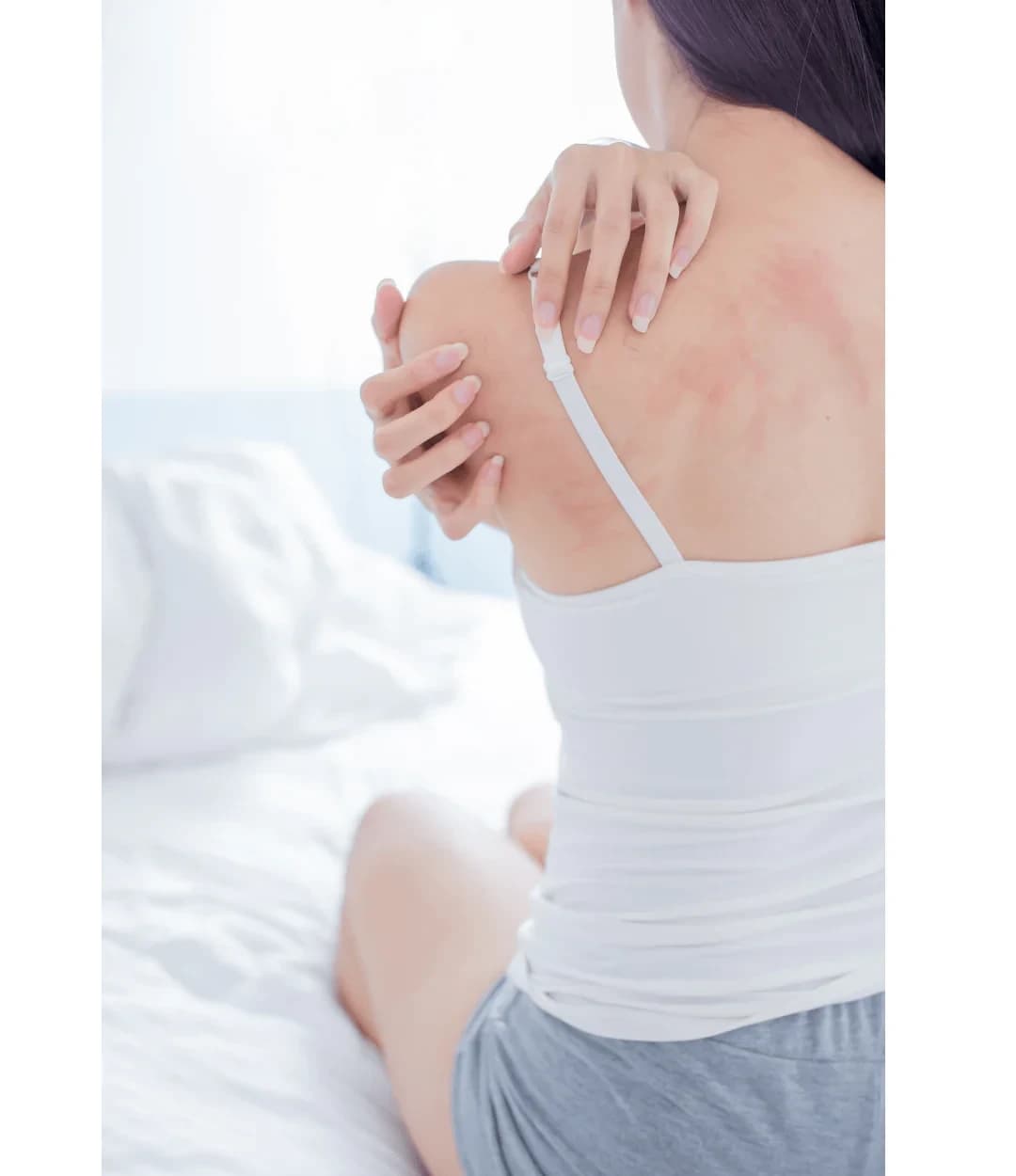 Natural Care for Atopic Skin