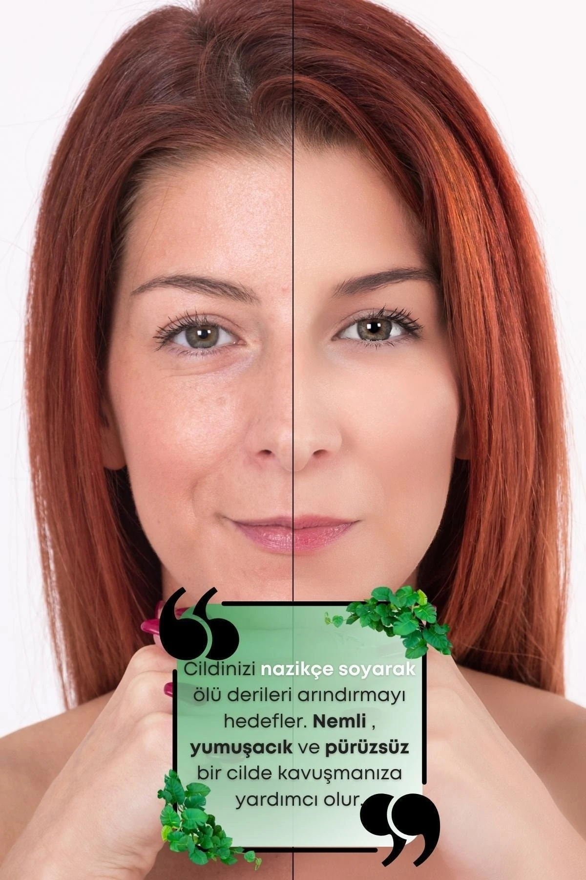 Red Peeling Serum Canlandırıcı, Yenileyici, Gözenek Sıkılaştırıcı, Leke Ve Akne Karşıtı, Antioksidan