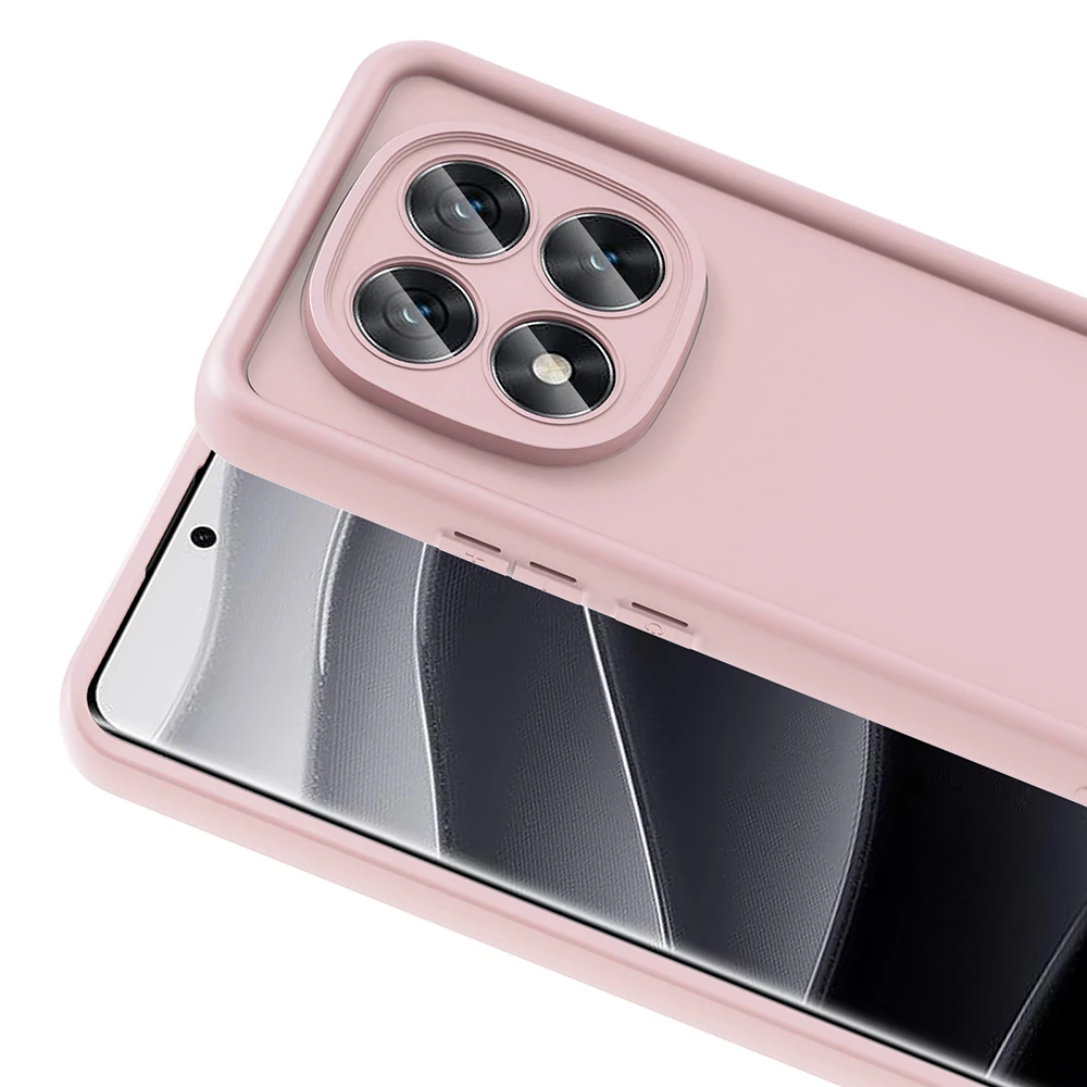 Xiaomi Poco X7 Kılıf Kamera Korumalı Zore Ananas Kapak