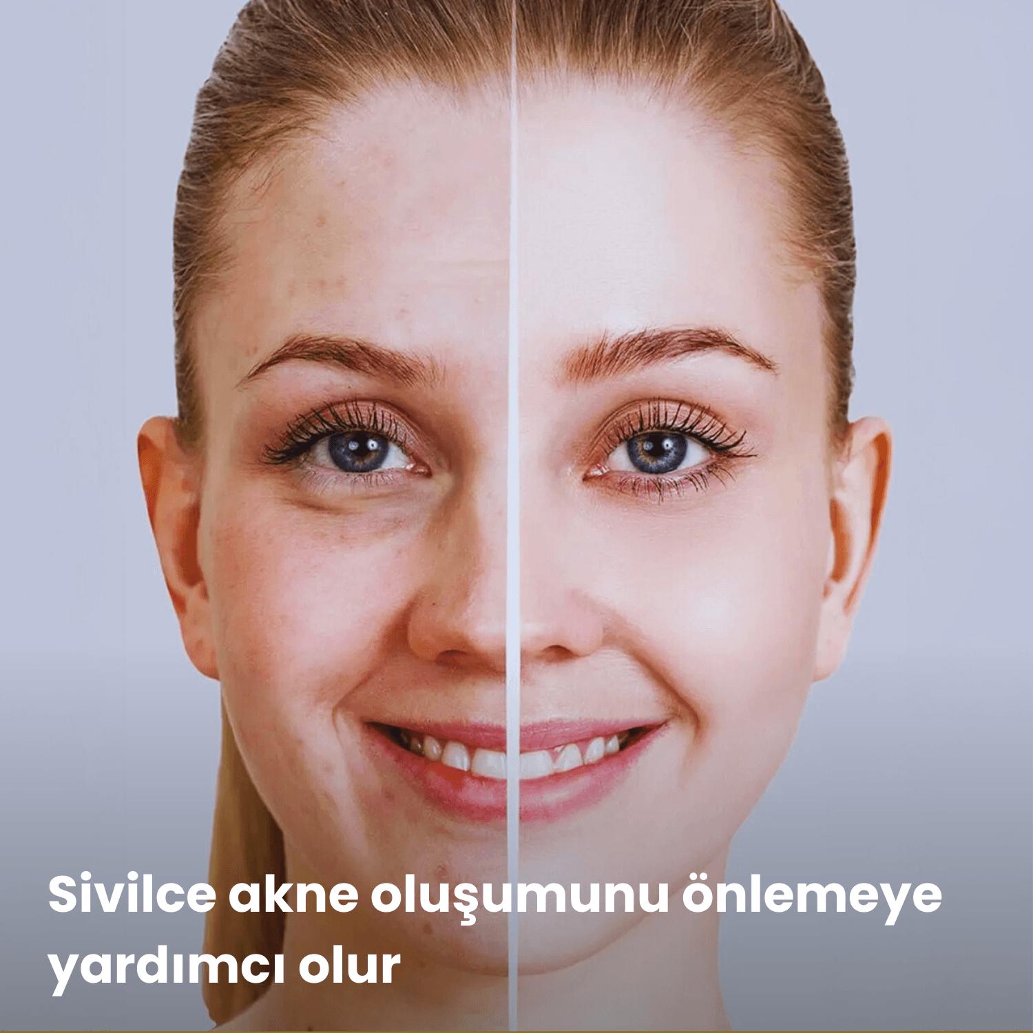 C Vitamini Serum | C Vitaminli Aydınlatıcı Cilt Bakım Serumu | 30 mL