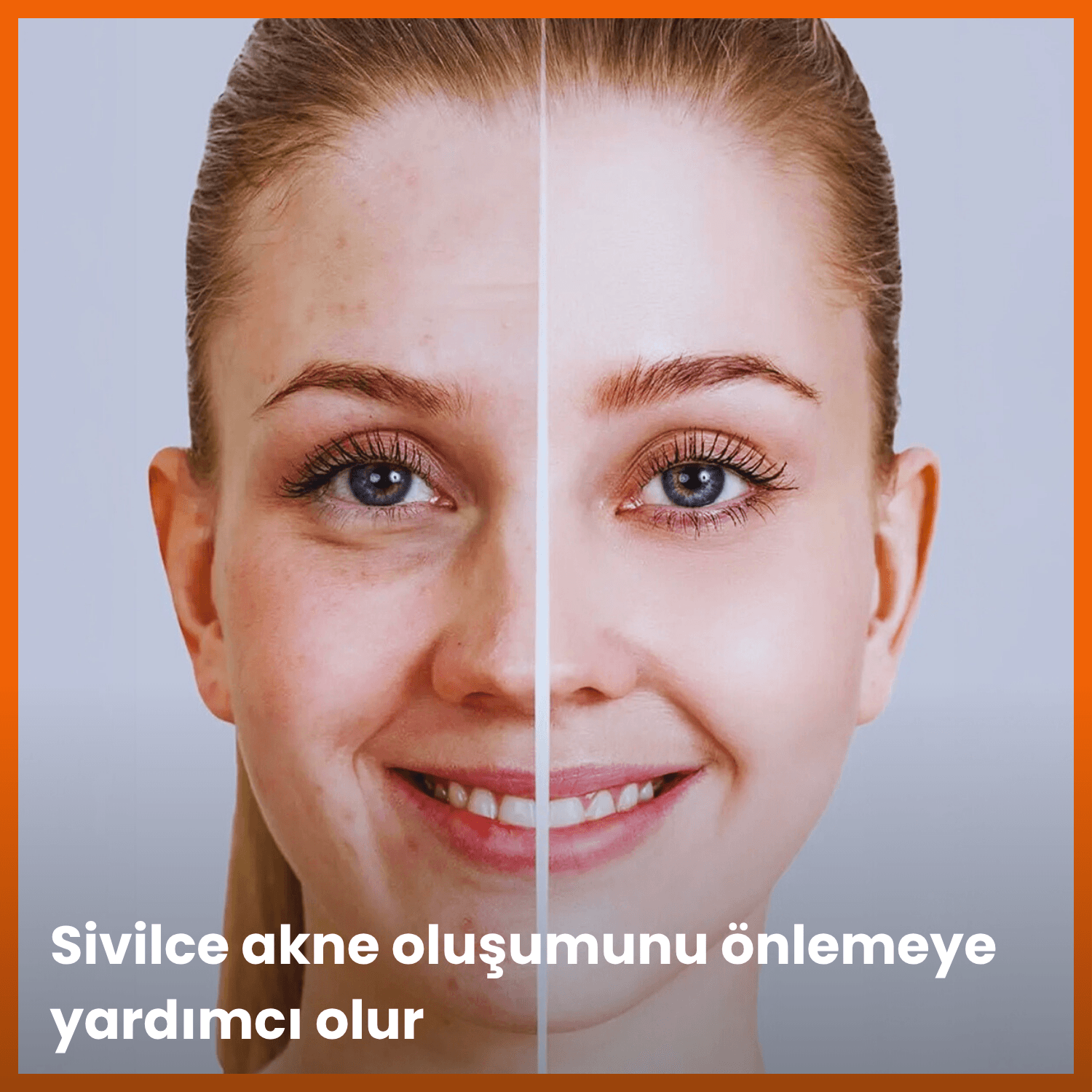 C Vitamini Serum | C Vitaminli Aydınlatıcı Cilt Bakım Serumu | 30 mL