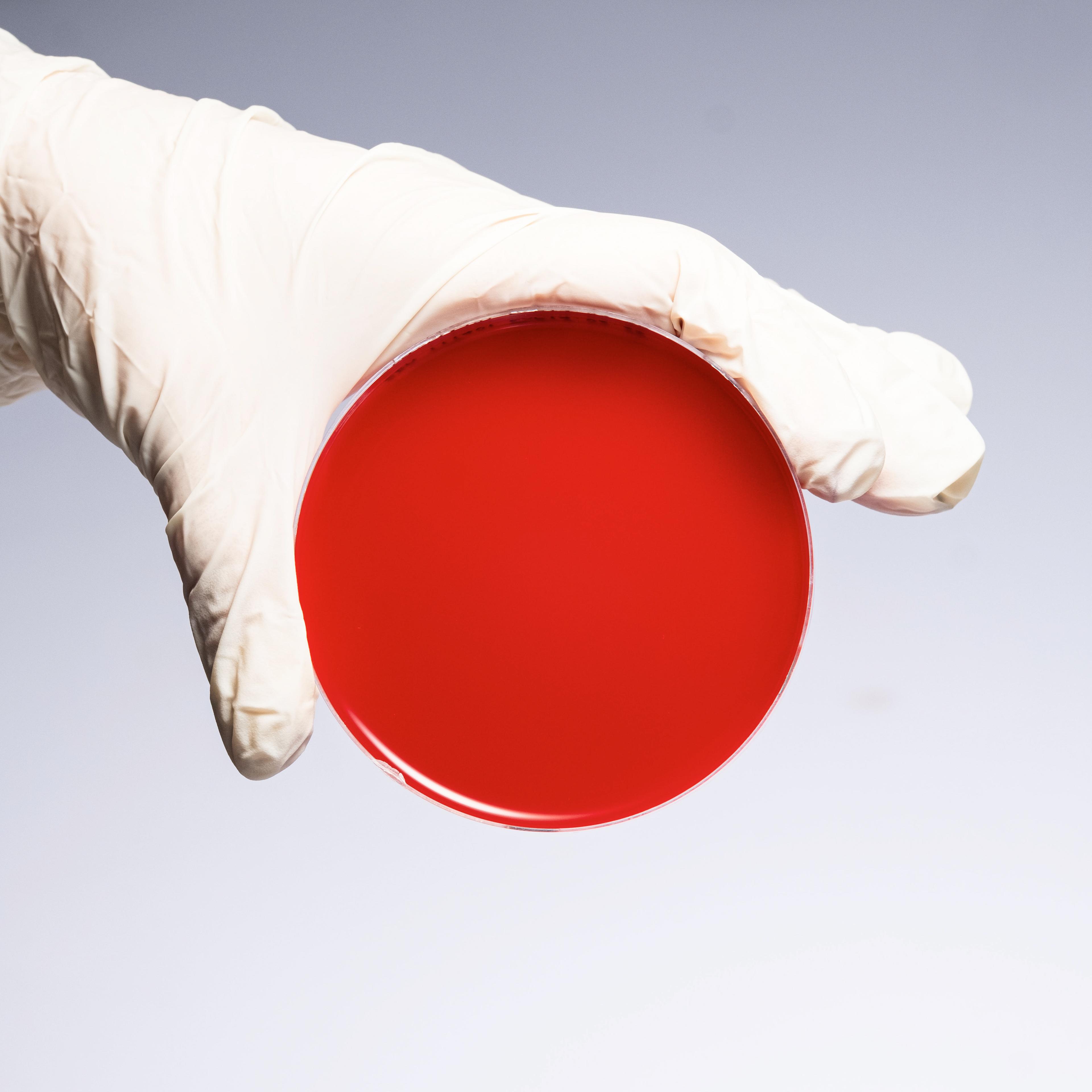 PREPARED SHEEP BLOOD AGAR