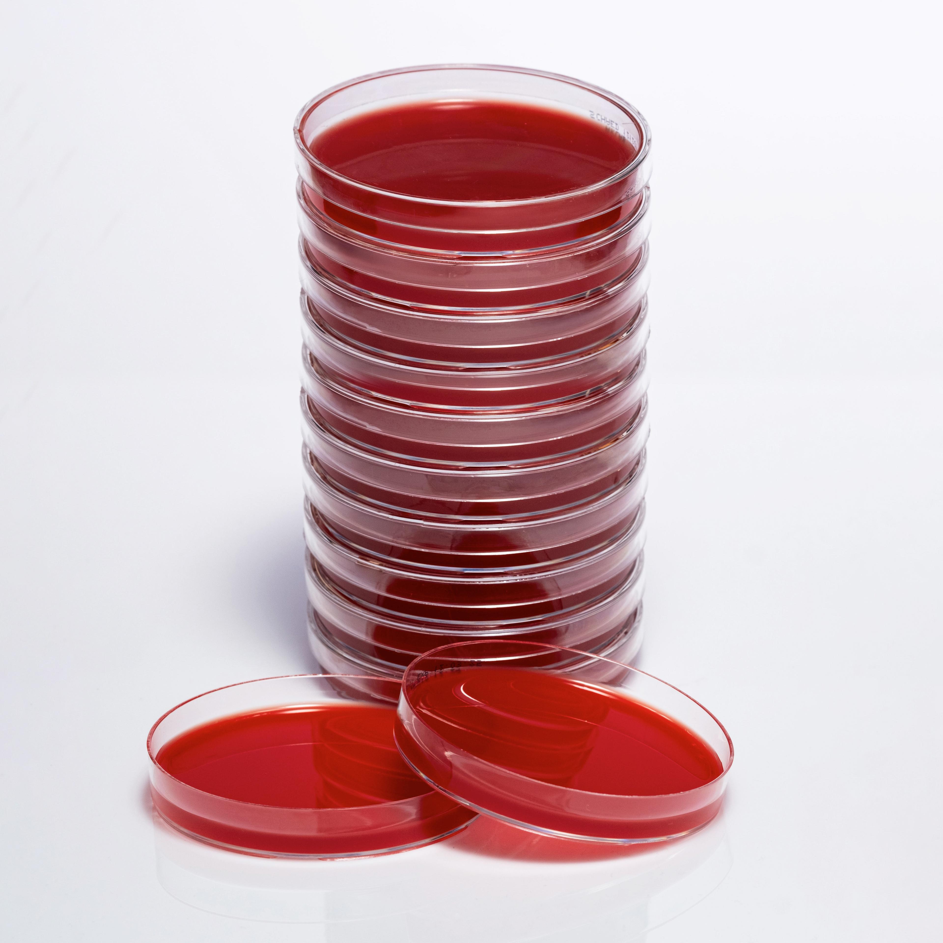 PREPARED SCHAEDLER AGAR image