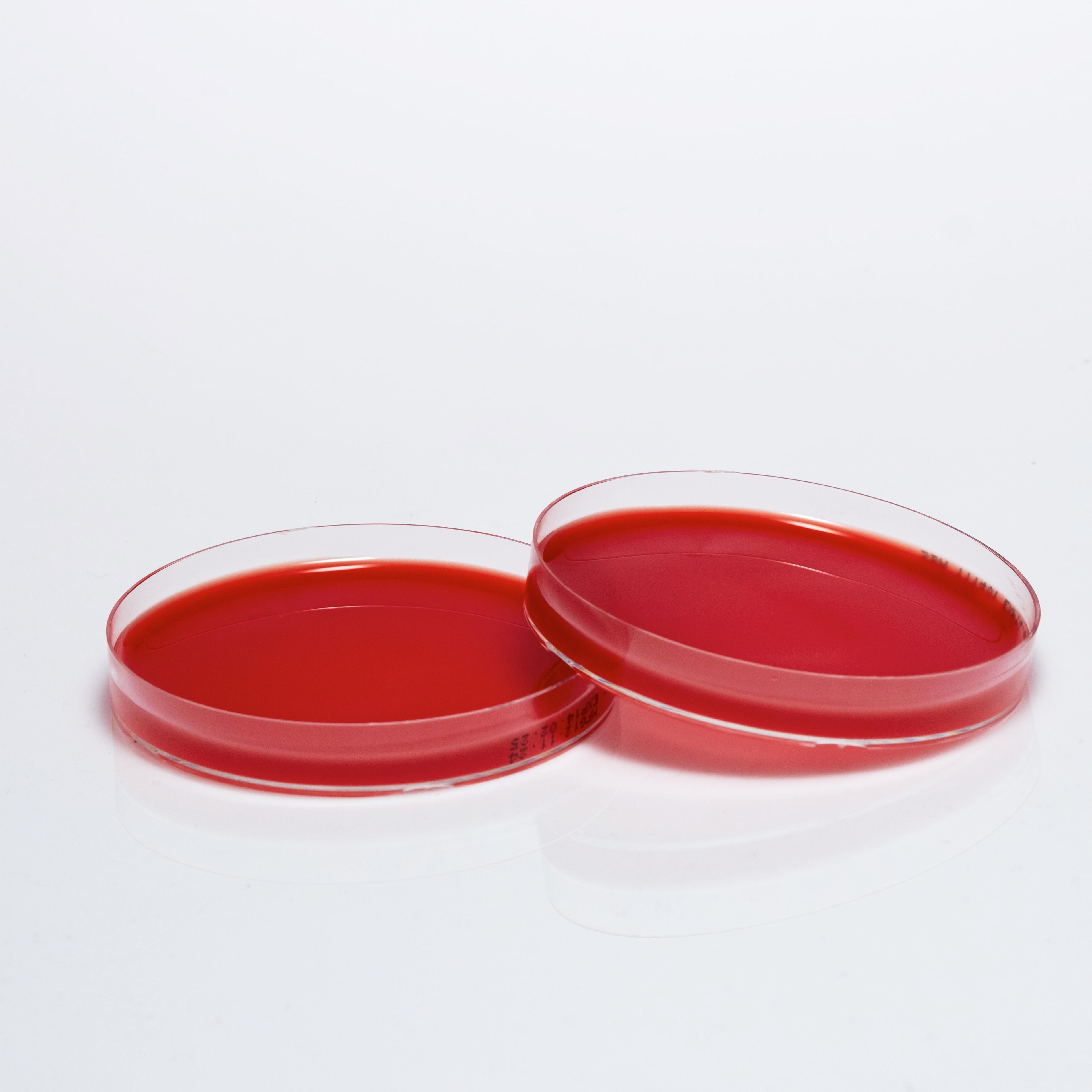 PREPARED SHEEP BLOOD AGAR