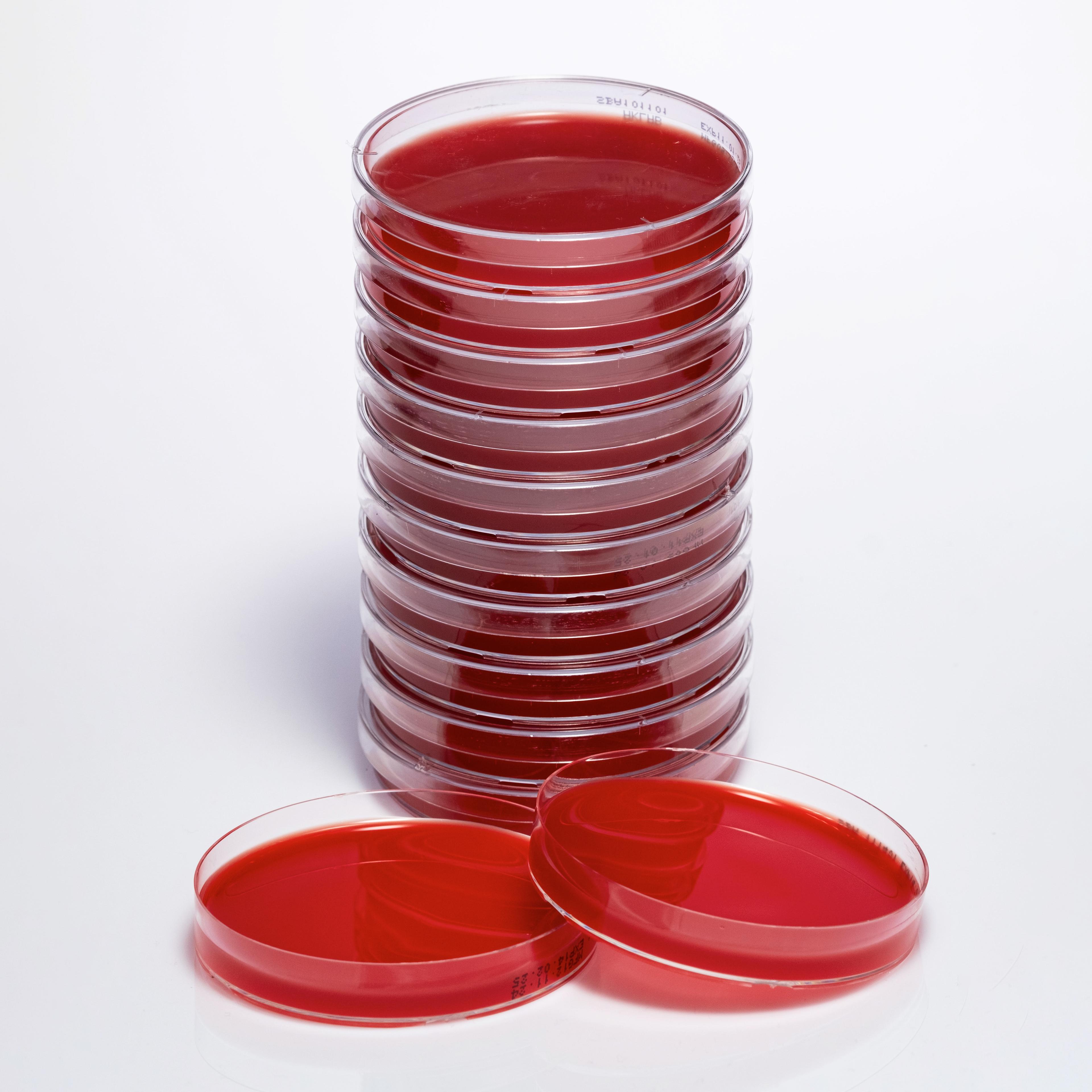 PREPARED SHEEP BLOOD AGAR