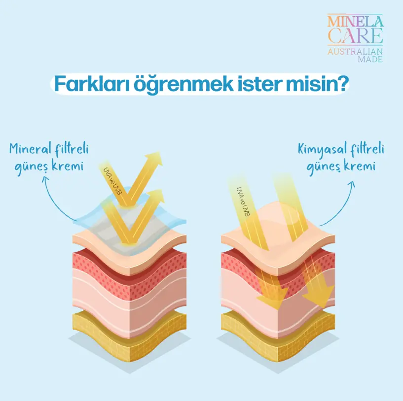 Mineral Filtre ve Kimyasal Filtre Farkı infografik