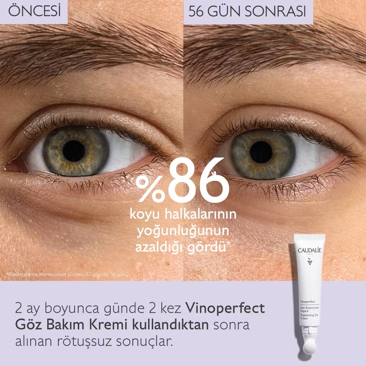 Caudalie Vinoperfect Işıltı Verici Göz Bakım Kremi 15 ml