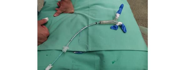 3D baskı akciğer modeli