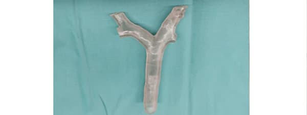 3D baskı akciğer modeli