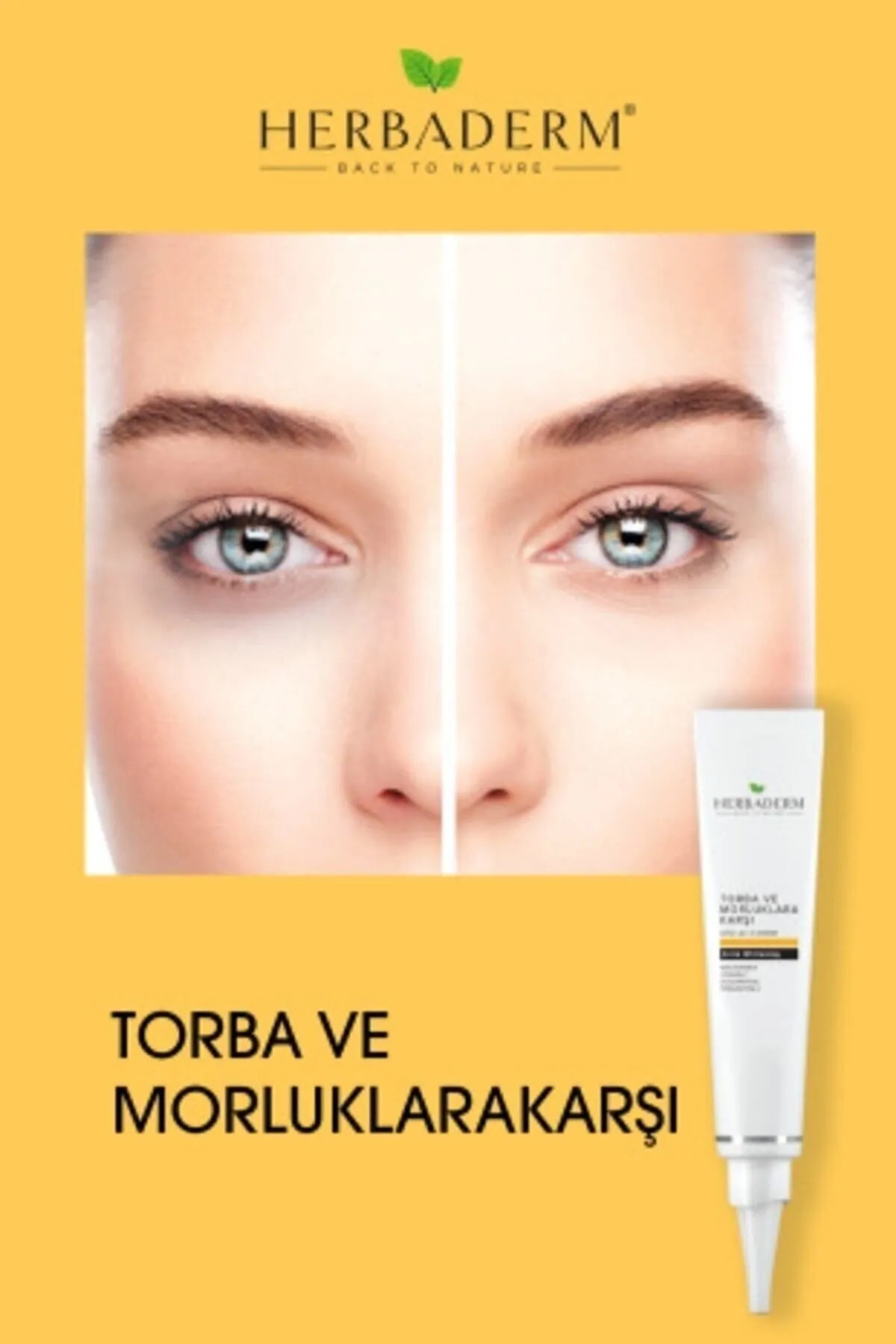 Torba Ve Morluklara Karşı Göz Altı Kremi 15 ml