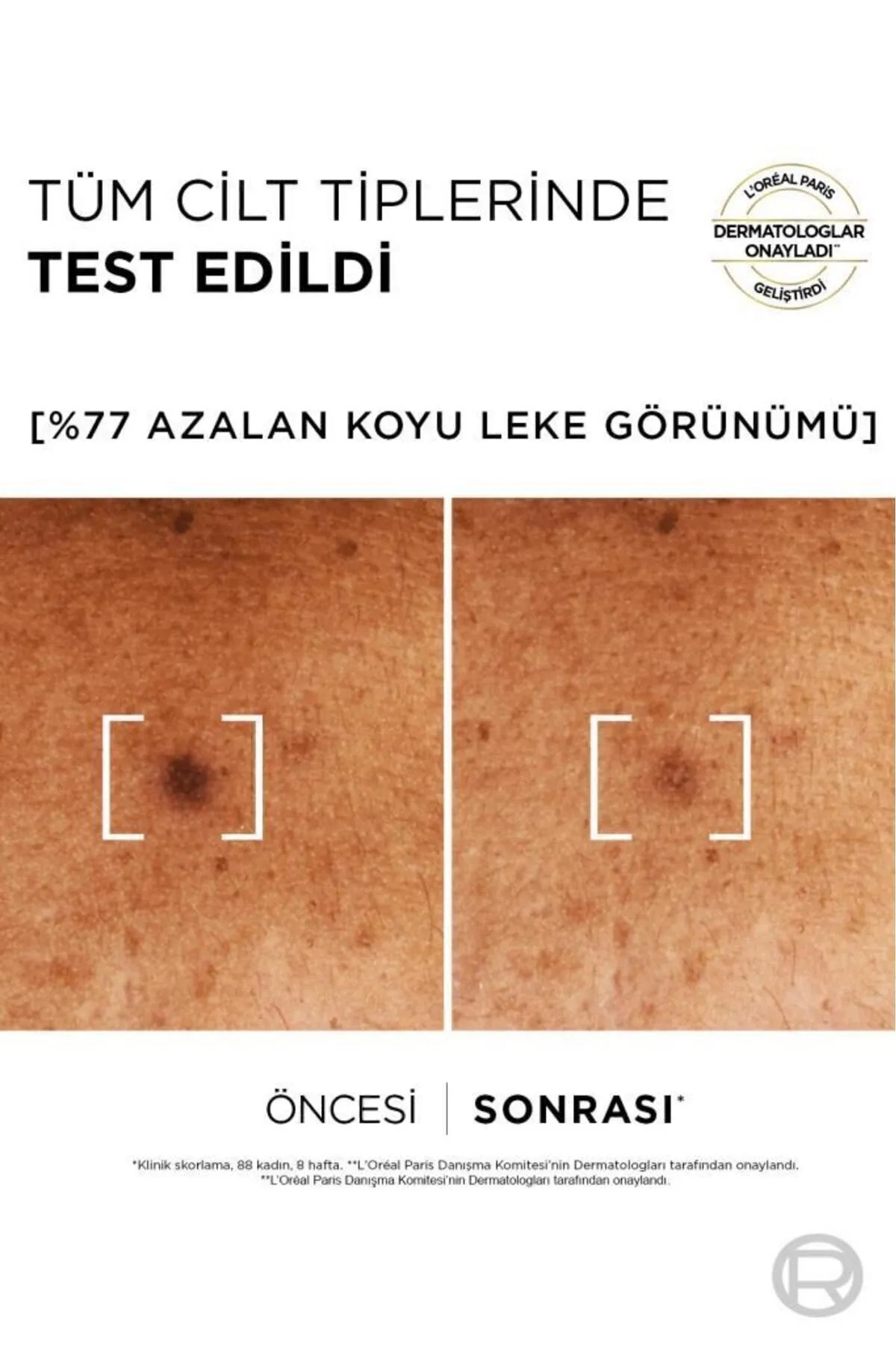 L'Oreal Paris Bright Reveal Sivilce,Güneş,Yaşlanma Lekelerinde Etkili Koyu Leke Karşıtı Cilt Serumu