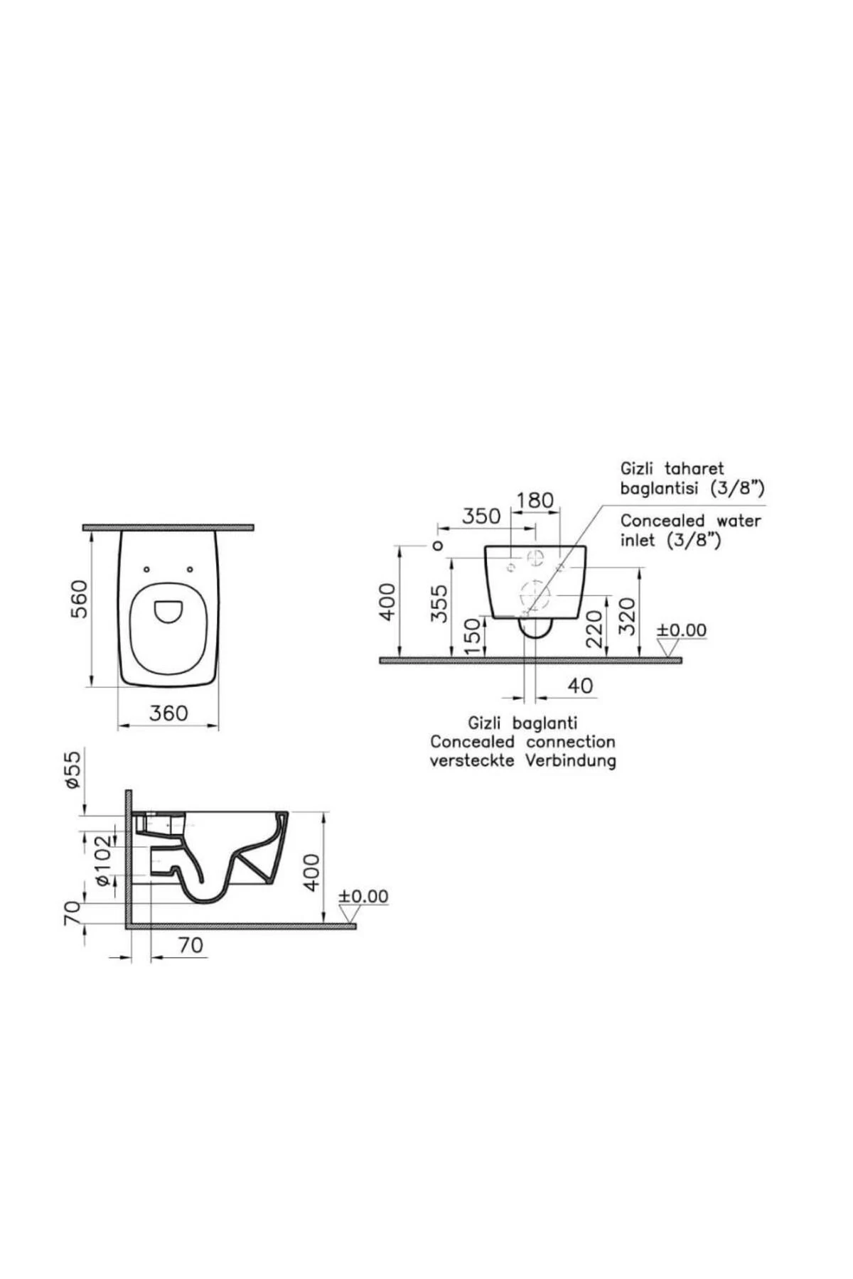 Metropole Rim-Ex Kanlasız Asma Klozet + Duroplast Slim Yavaş Kapanan Klozet Kapağı SET