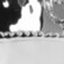 CER1717-1719-1721
