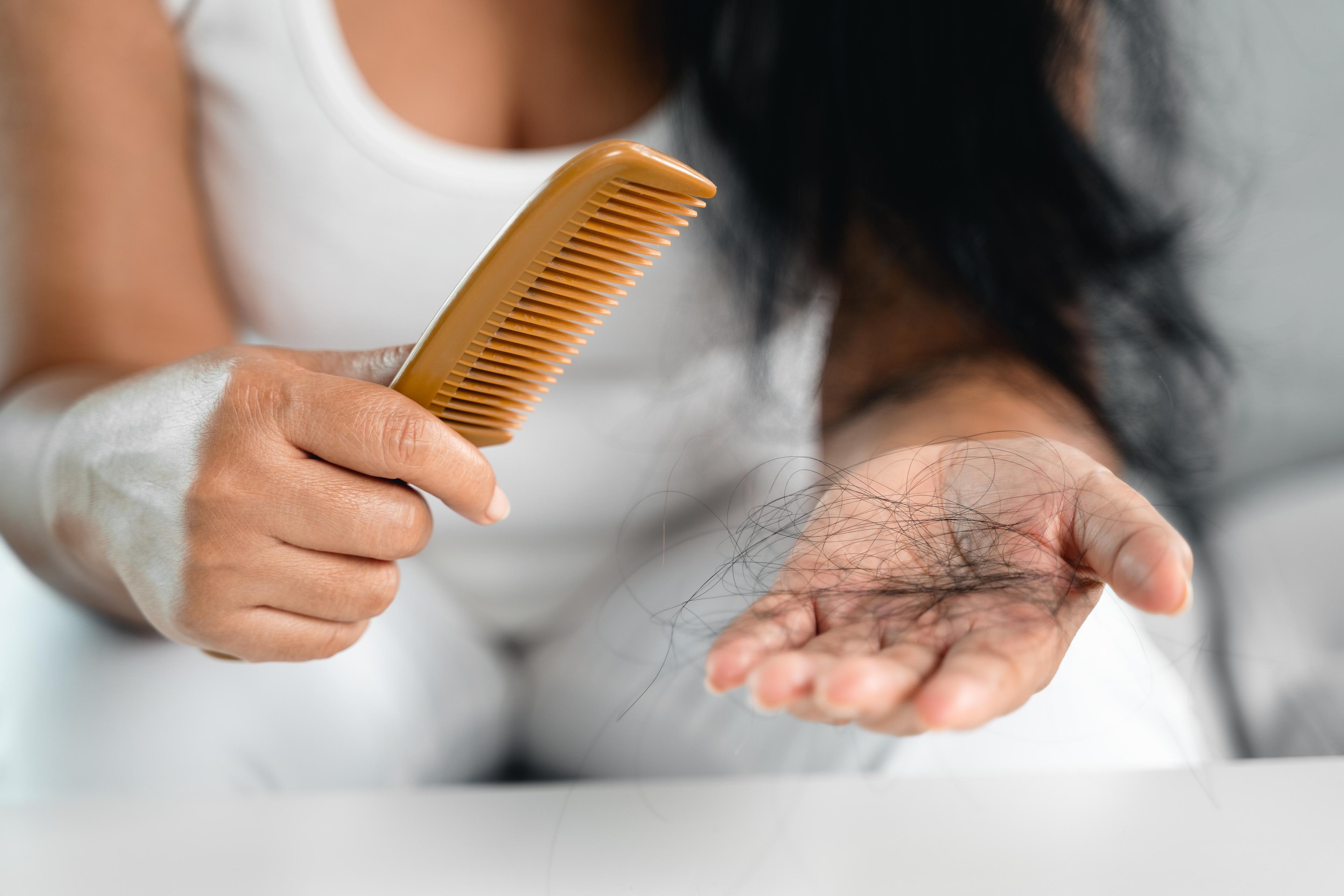 Saç Dökülmesi Nedir? Nasıl Önlenir?