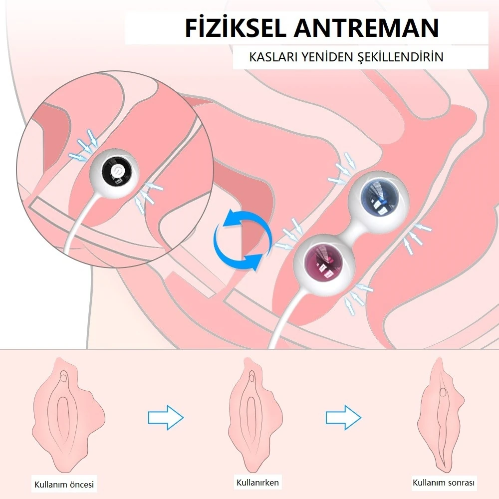 Freezer 9 Modlu Titreşimli Kumandalı Şarjlı Su Geçirmez Kegel Egzersiz Seti