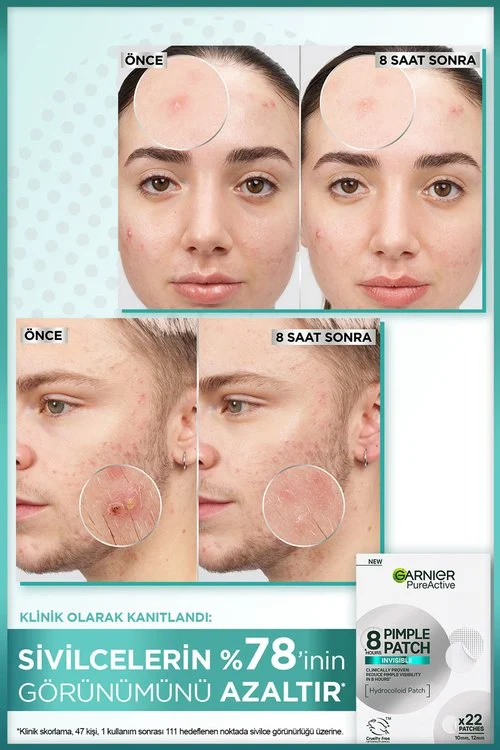Garnier Pimple Patch Sivilce Bandı 22'li - Hidrokolloid Bant