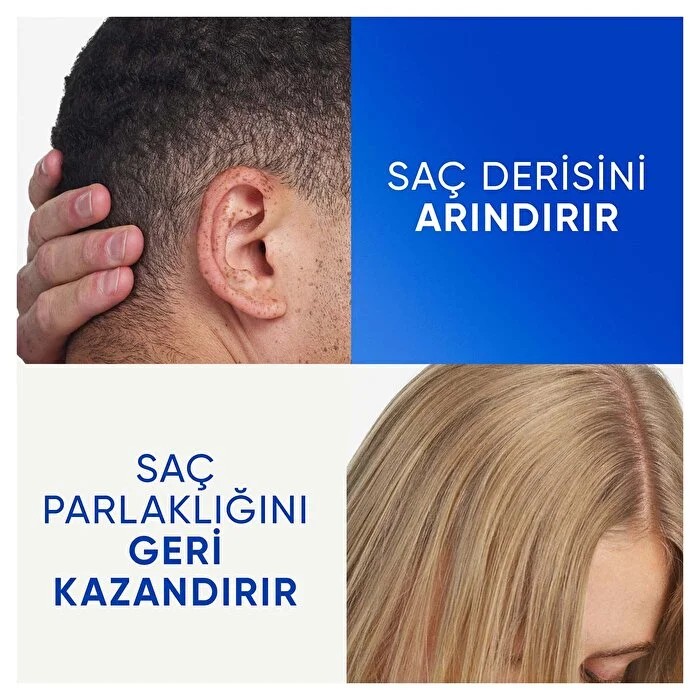 Head & Shoulders Şampuan Elma Sirkeli 330 ml