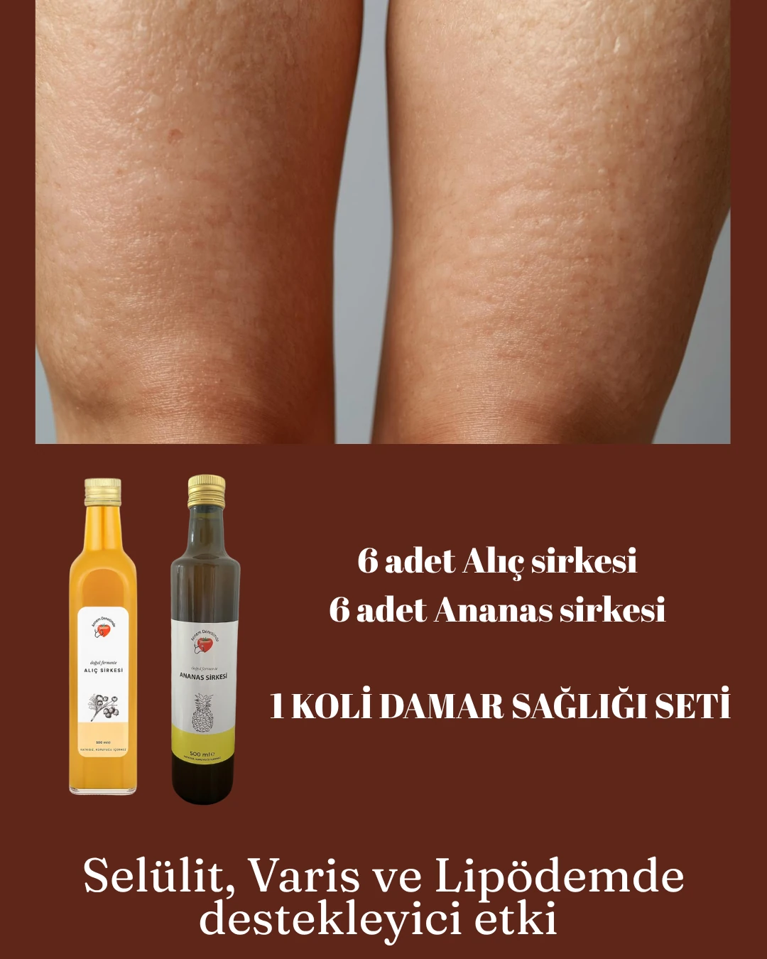 DAMAR SAĞLIĞI DESTEK PAKETİ 6 ALIÇ 6 ANANAS SİRKESİ