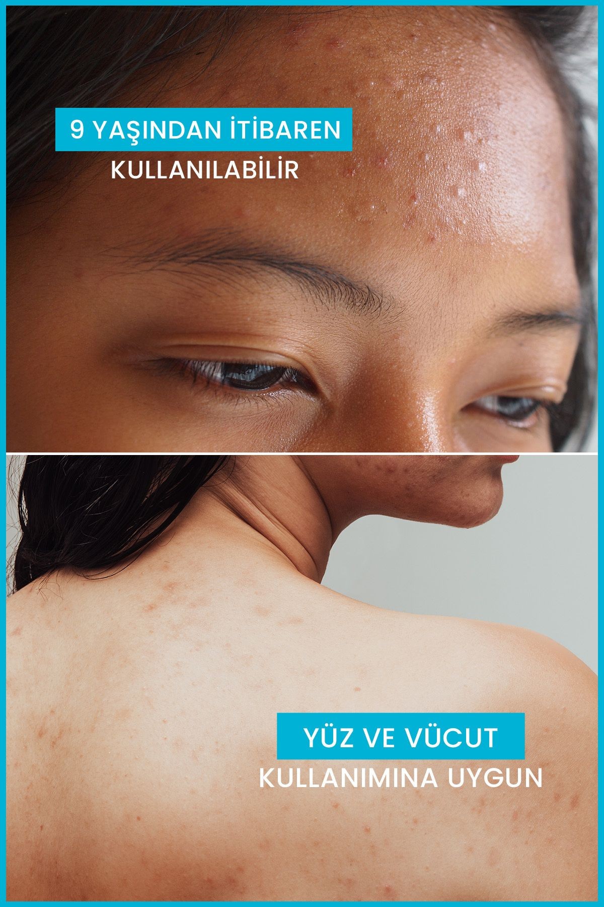 Ducray Keracnyl Yağlı ve Akneye Eğilimli Ciltler için Temizleme Jeli 400 ml
