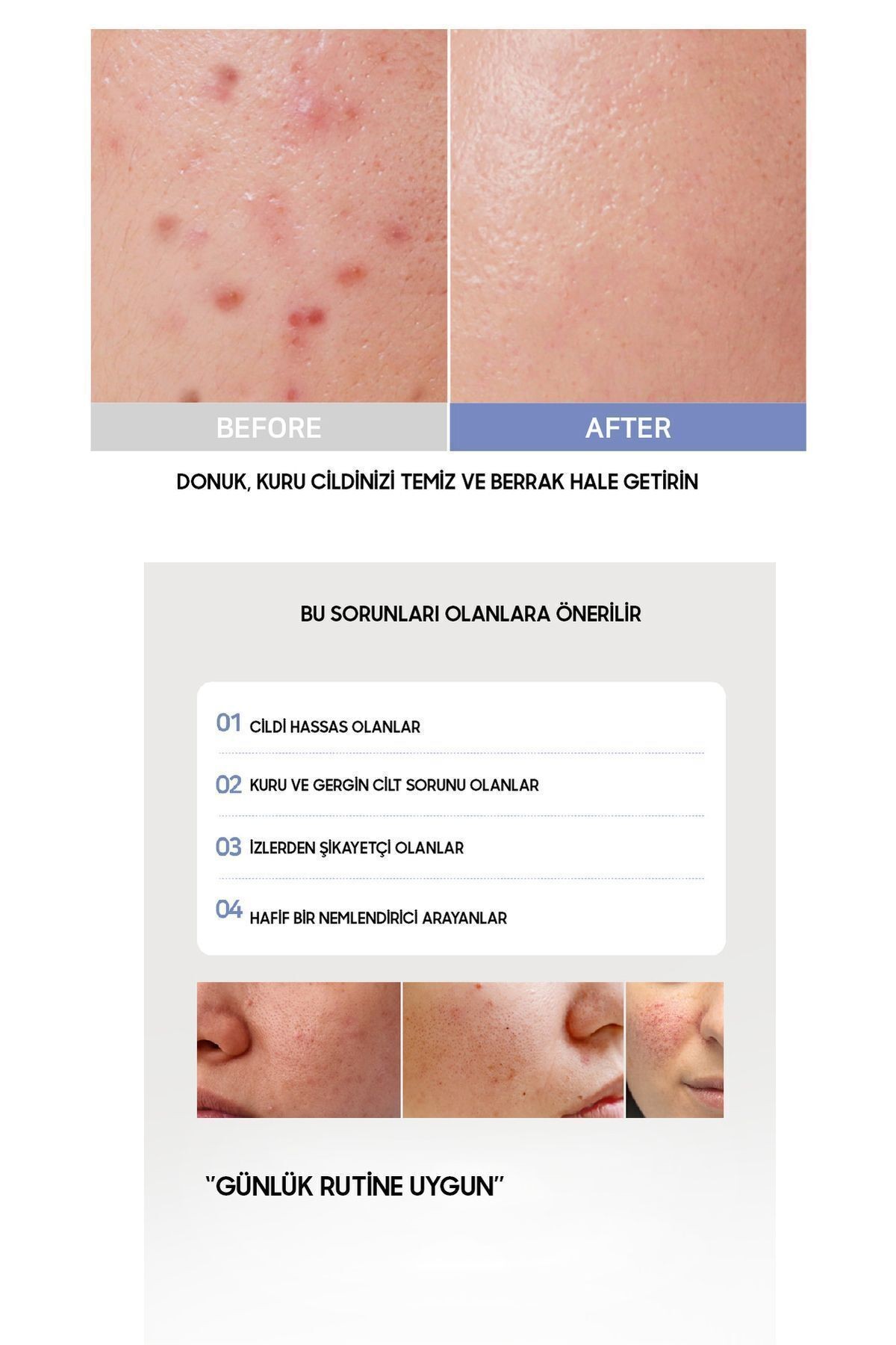Kırışıklık Karşıtı Yoğun Nem Sağlayan Intensive Moisture Face Serum (KREM)