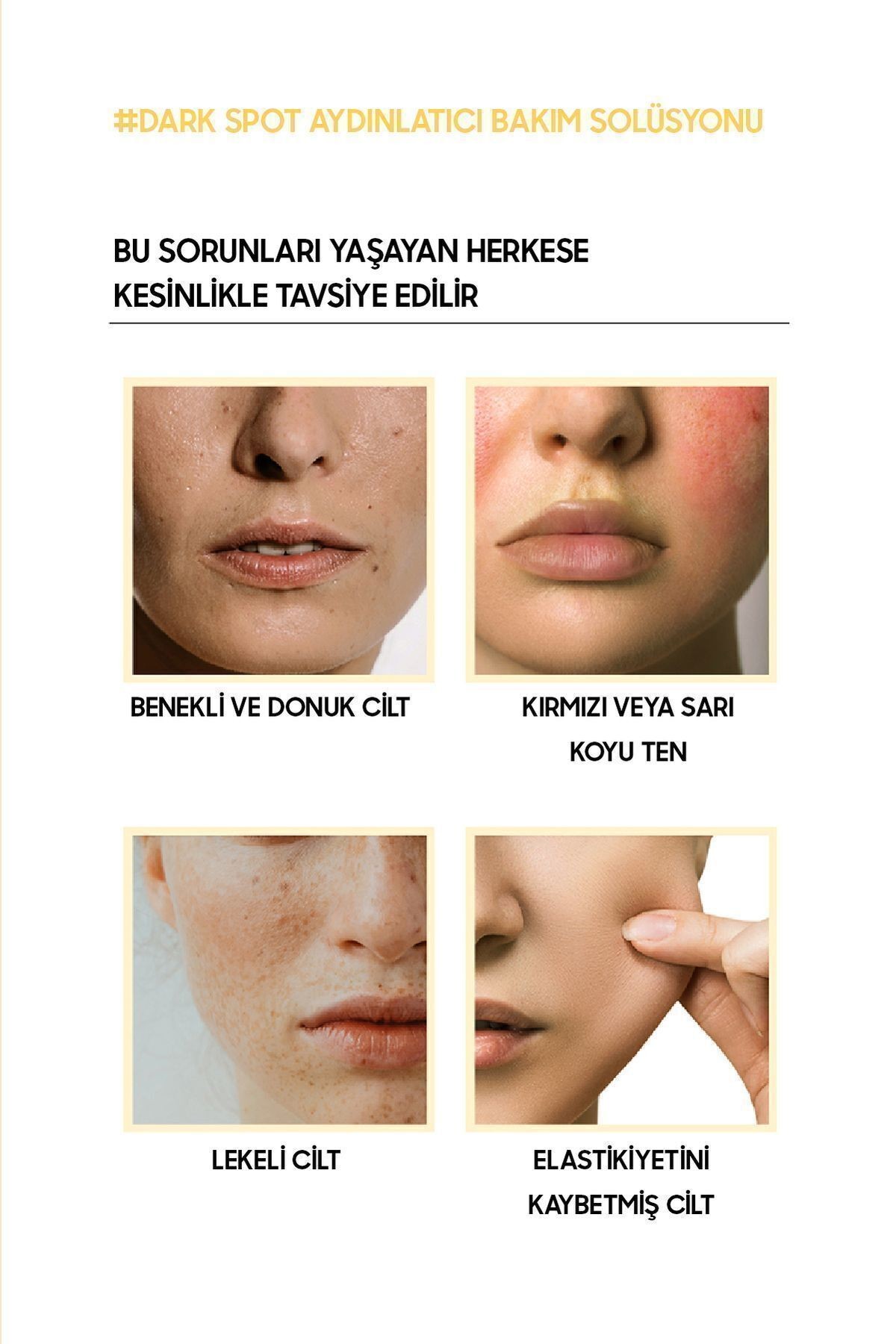 Koyu Cilt Lekeleri İçin Aydınlık Görünüm Sağlayan Dark Spot Vita C Serum