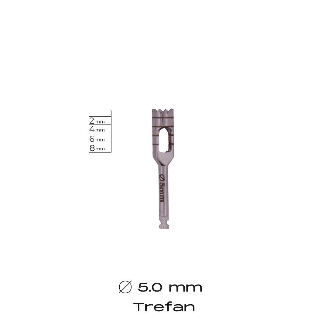 Trefan - 5.0mm