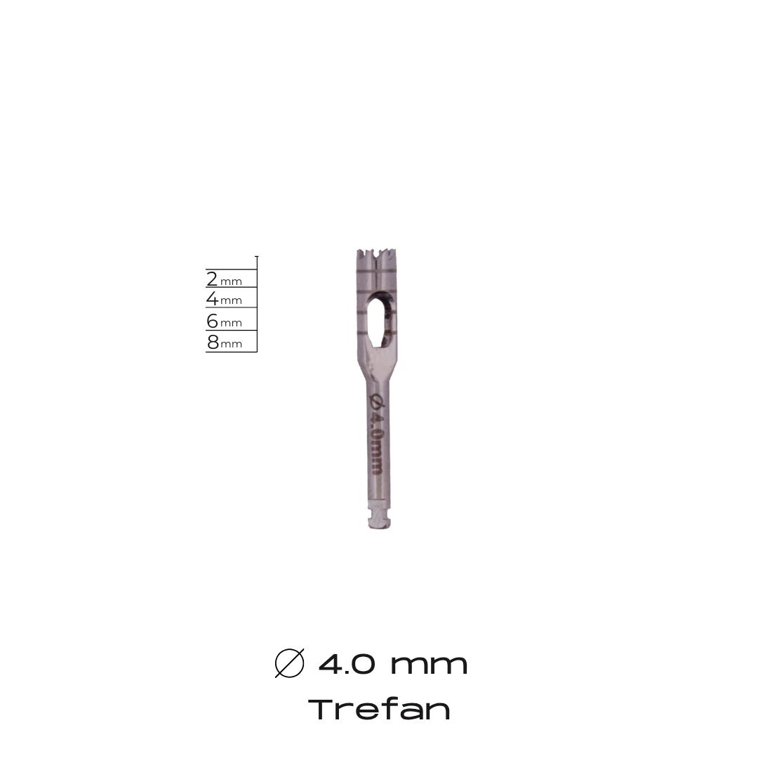 Trefan - 4.0mm
