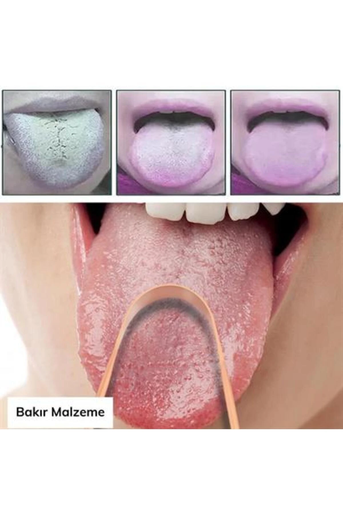 Bakır Oil Pulling Yağ Çekme Dil Plak Temizleme Aleti Dil Fırçası Sıyırıcı Dil Kaşığı