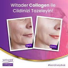 Witader kırışıklık ve Akne Giderici Collagen Cream 100ml 2li set