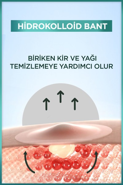 Garnier 8 Saat Görünmez Cilt Kusurları

Görünümü Karşıtı Bant (Pimple Patch) 22 

Adet