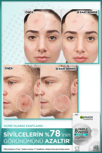 Garnier 8 Saat Görünmez Cilt Kusurları

Görünümü Karşıtı Bant (Pimple Patch) 22 

Adet