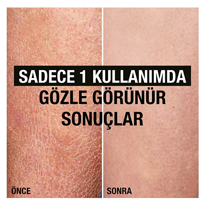 Neutrogena Yağ İle Zenginleştirilmiş Vücut Losyonu 250 ml