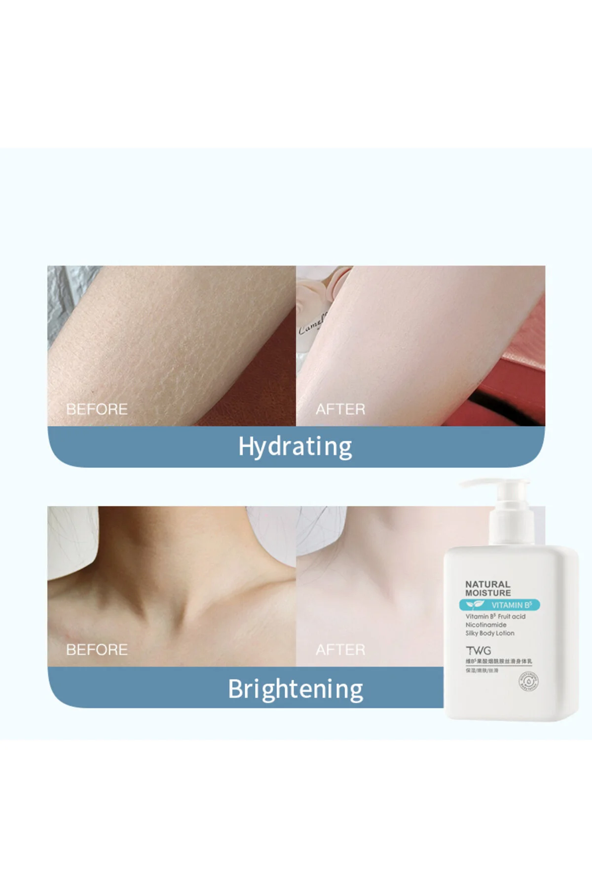 Niasinamid Vitamin B5 C VitaminiVücut Losyonu