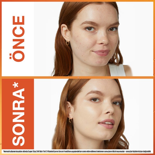 Maybelline New York Super Stay Skin Tint Fondöten - 03