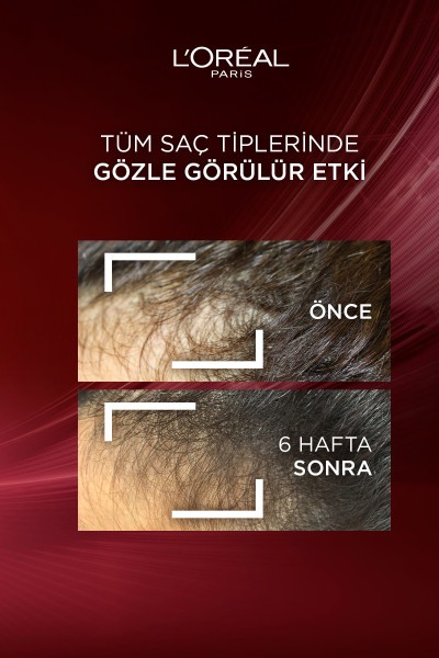 L'Oréal Paris Elseve Komple Direnç Dökülme Karşıtı Şampuan 300 ml