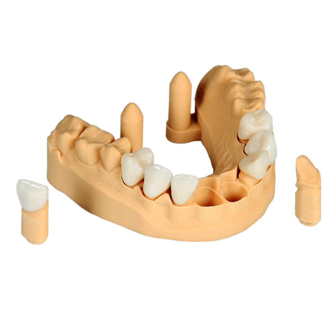 CRS Composite - CE Class IIA Certified Temporary and Permanent Resin