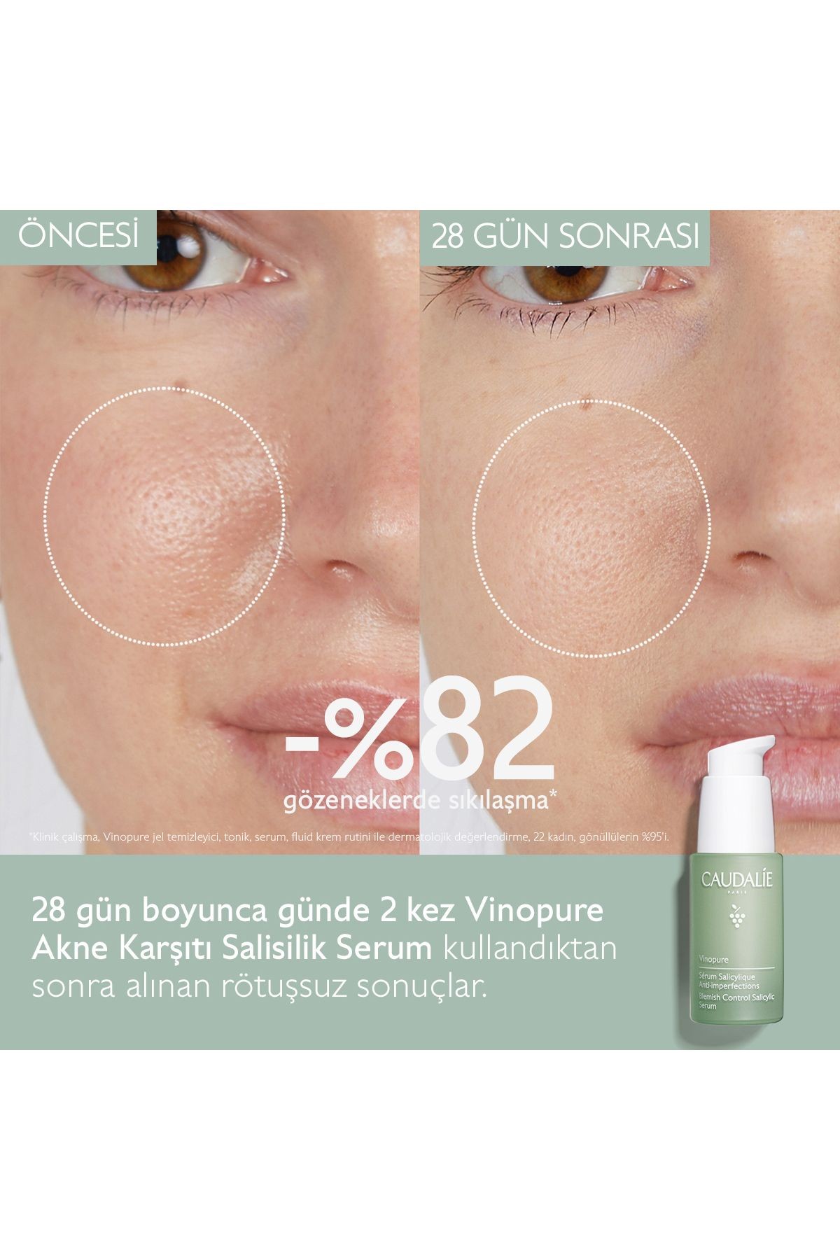 CAUDALİE Vinopure Akne Karşıtı SALİSİLİK Serum 30ML