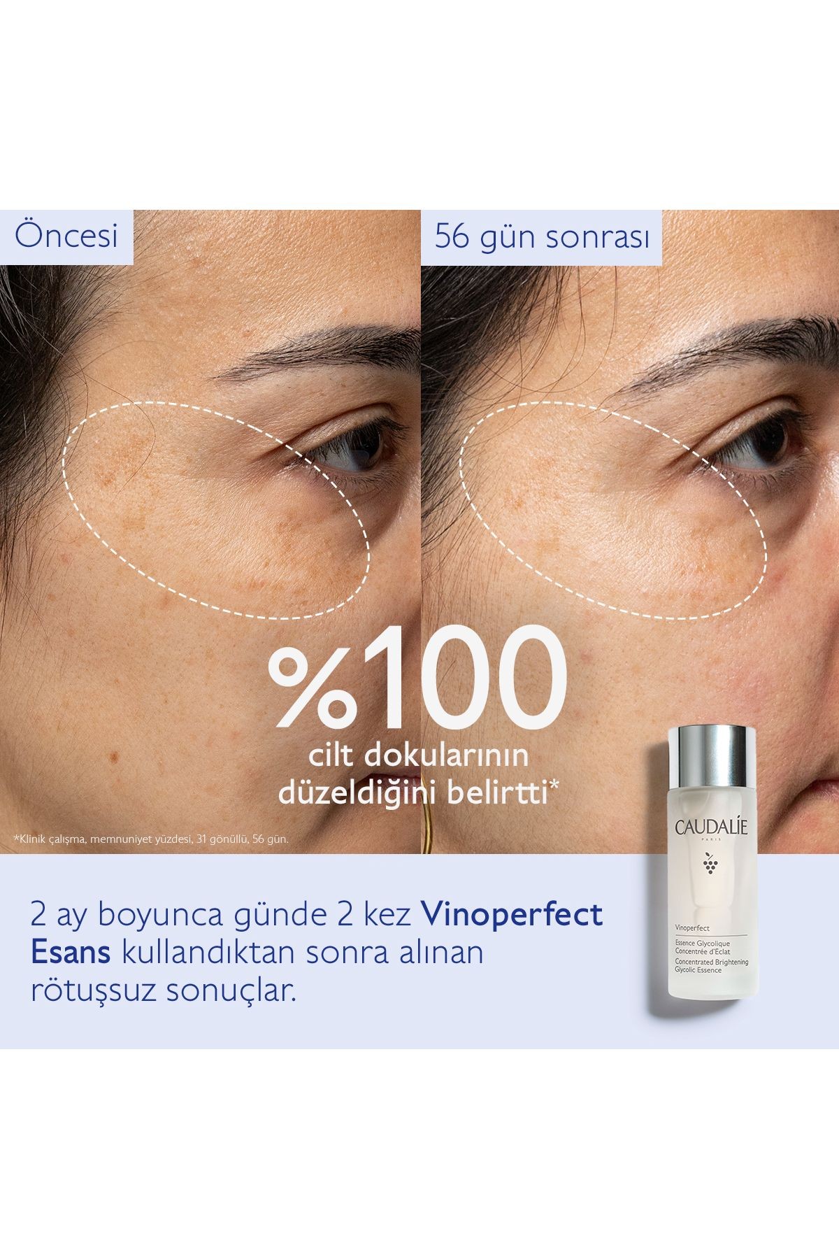 CAUDALİE Vinoperfect Esans 150 ml