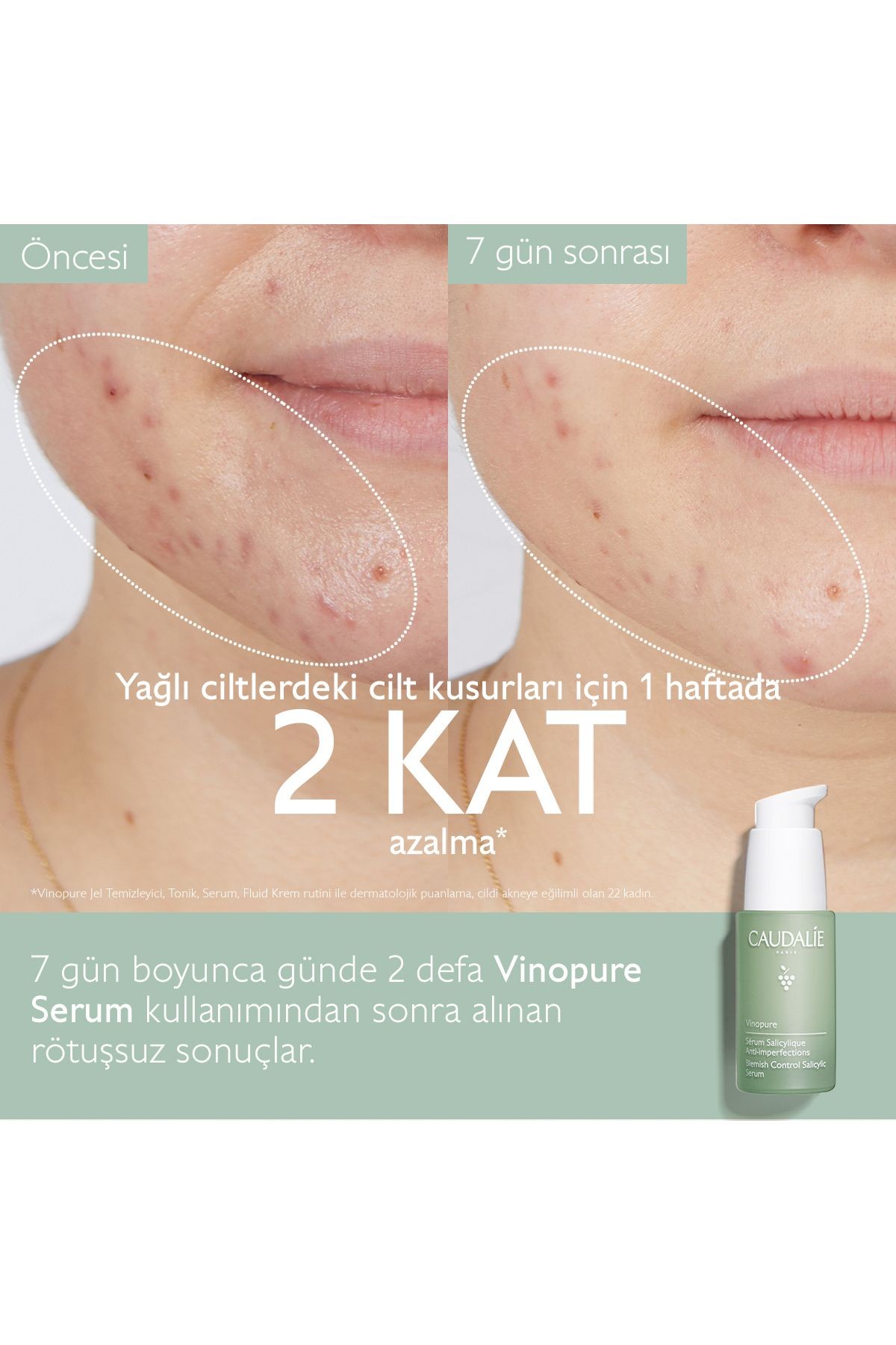 CAUDALİE Vinopure Akne Karşıtı SALİSİLİK Serum 30ML