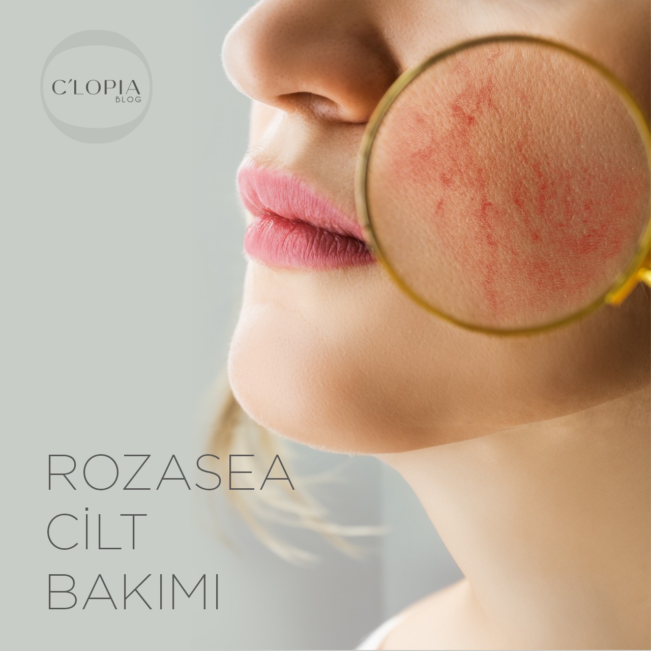 Rozasea Cilt Bakımı: Hassas Ciltler İçin Rehber