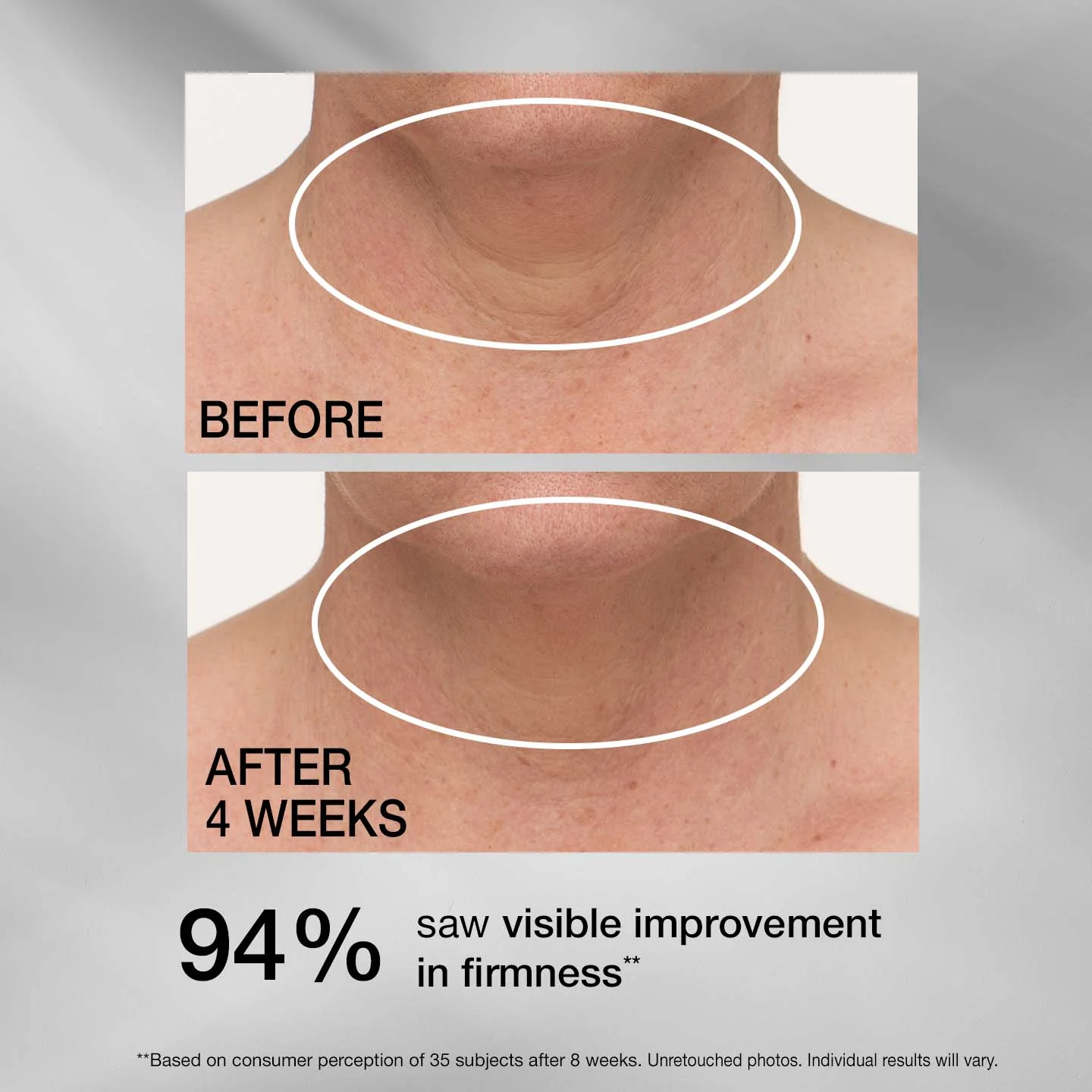 Tighten & Lift TL Advanced Tightening Neck Cream Plus 30 ml