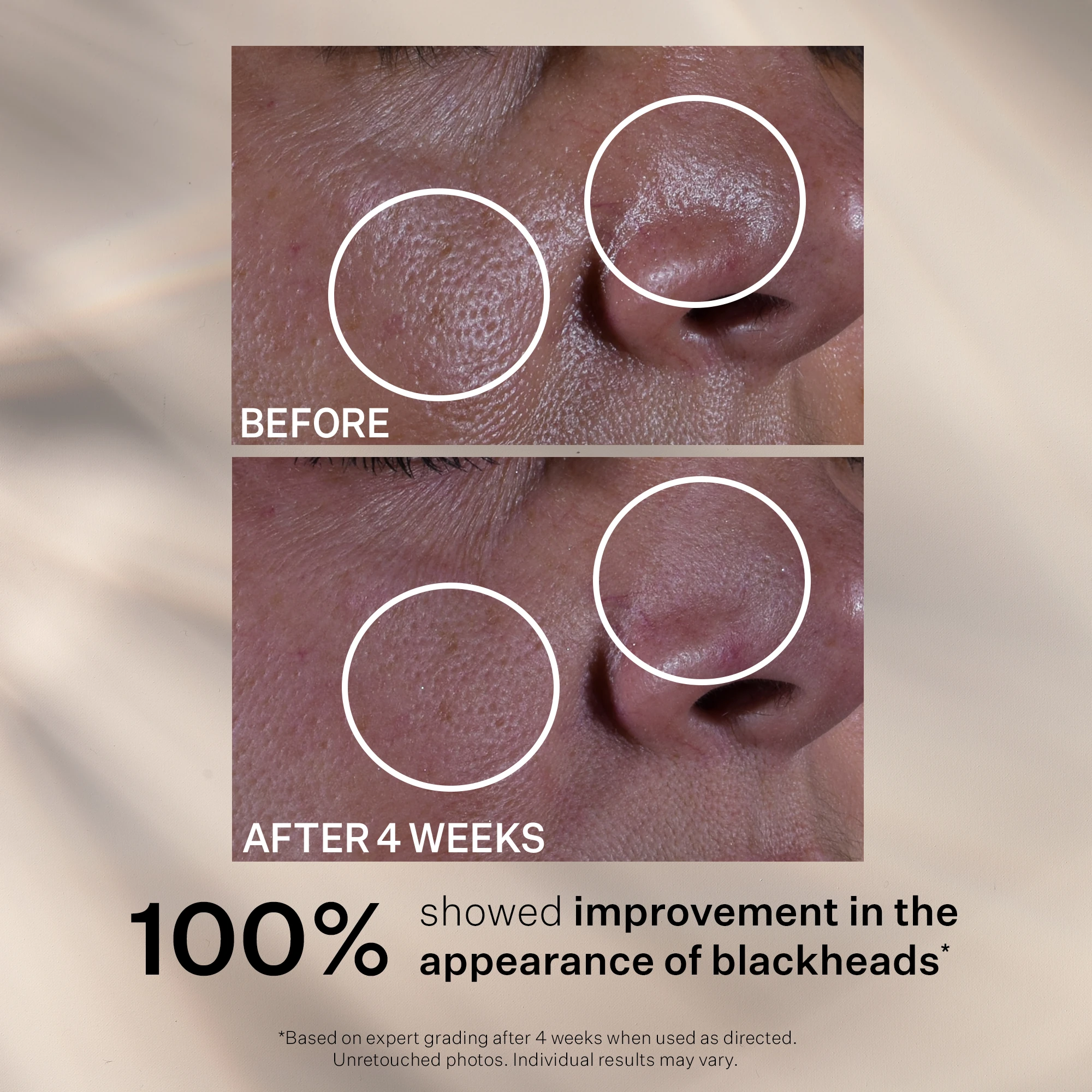 Multi Action Super Shrink Pore Minimizing Serum 30 ml