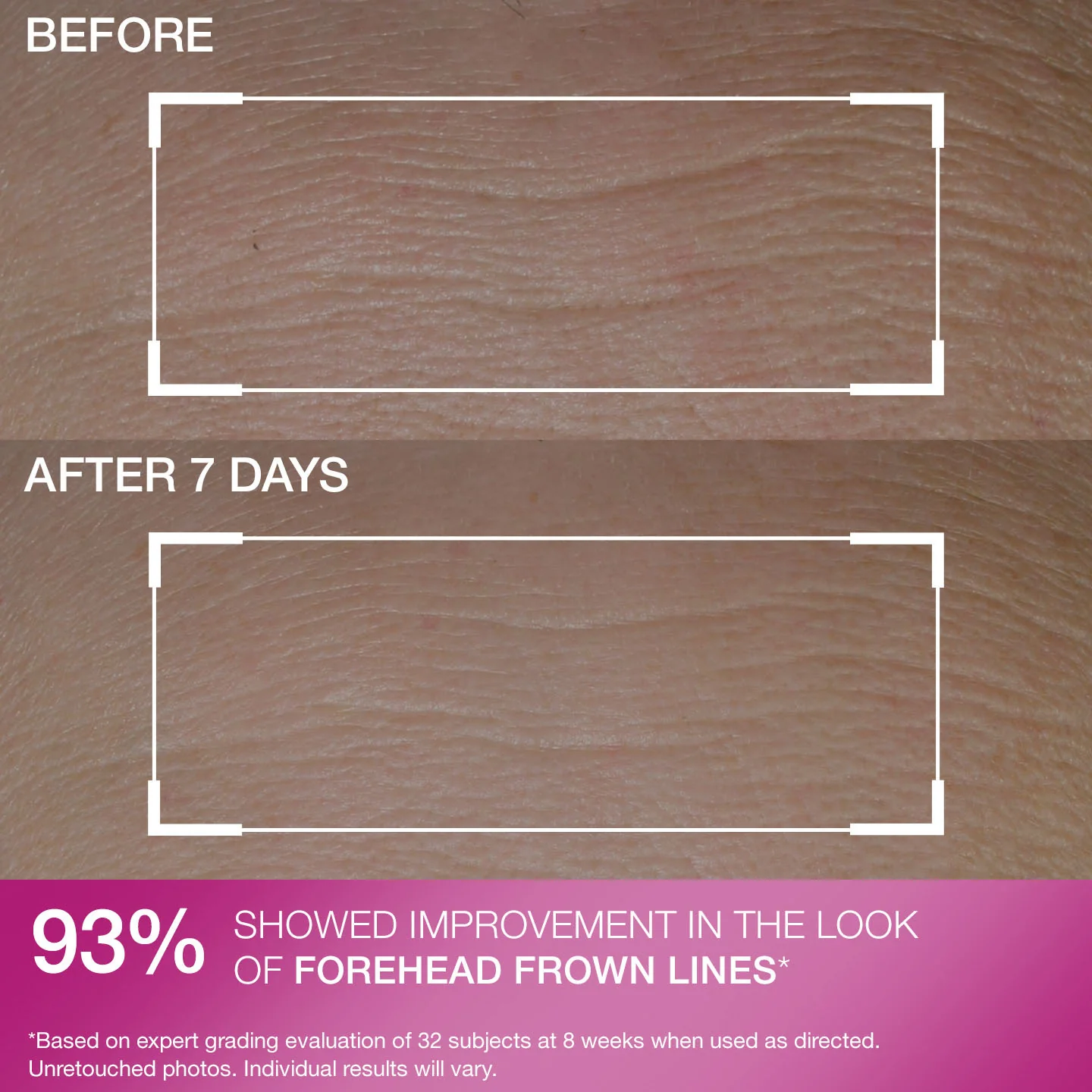 Anti Wrinkle Peptide Plump Line Filling Bounce Serum 30 ml