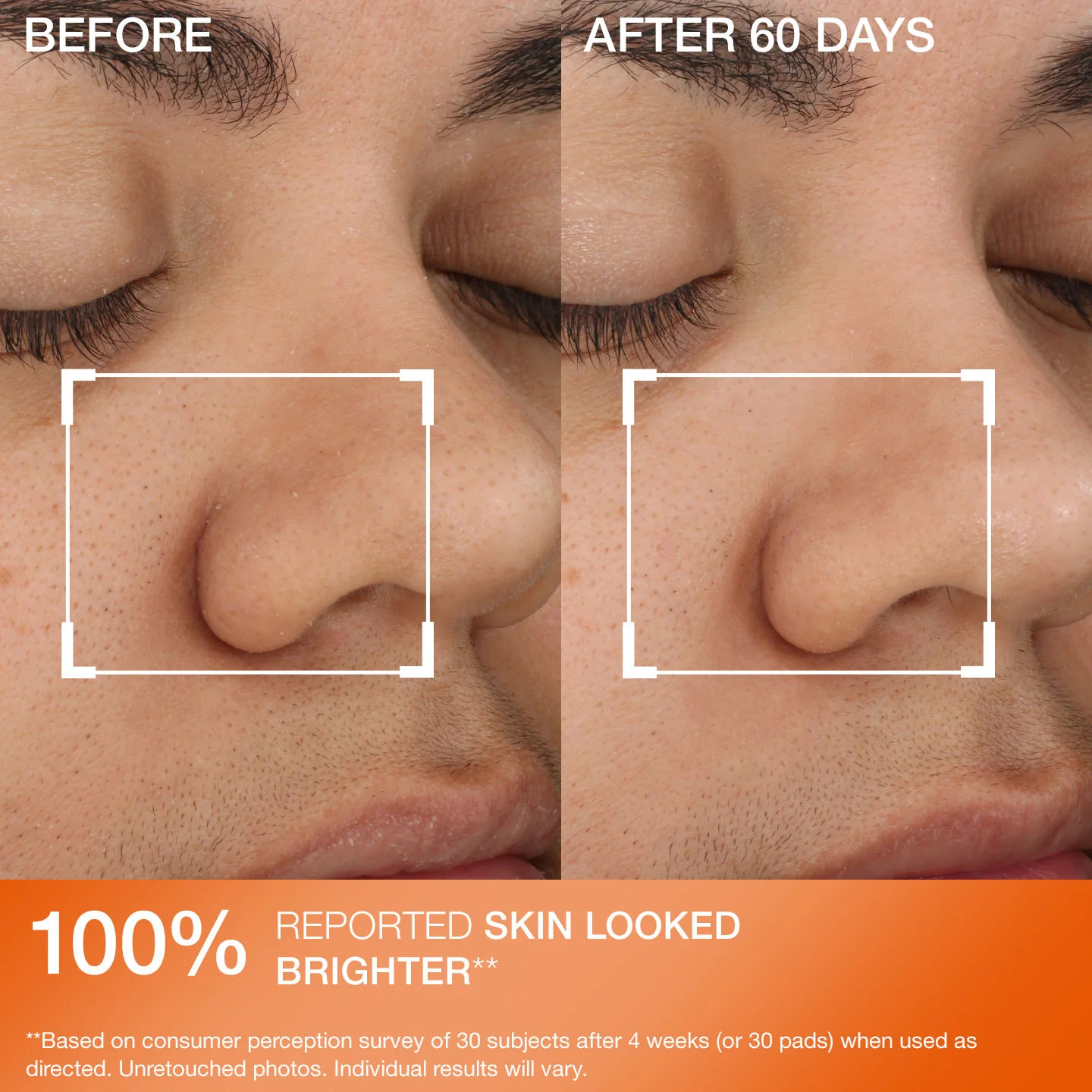 Advanced Resurfacing Daily Reveal Exfoliating Pads 60 Adet