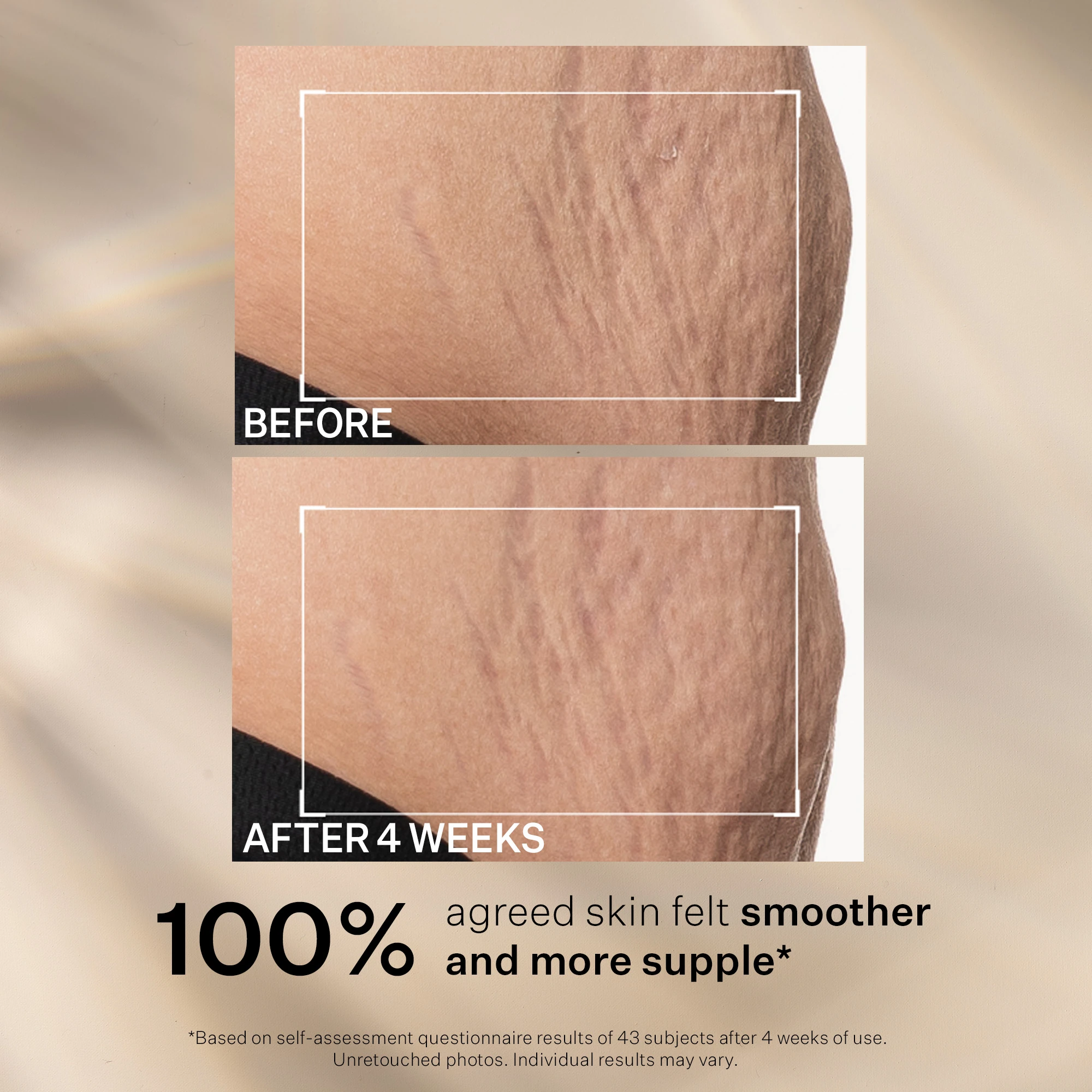 SD Advanced Plus Yoğun Nemlendirici Krem 60 ml